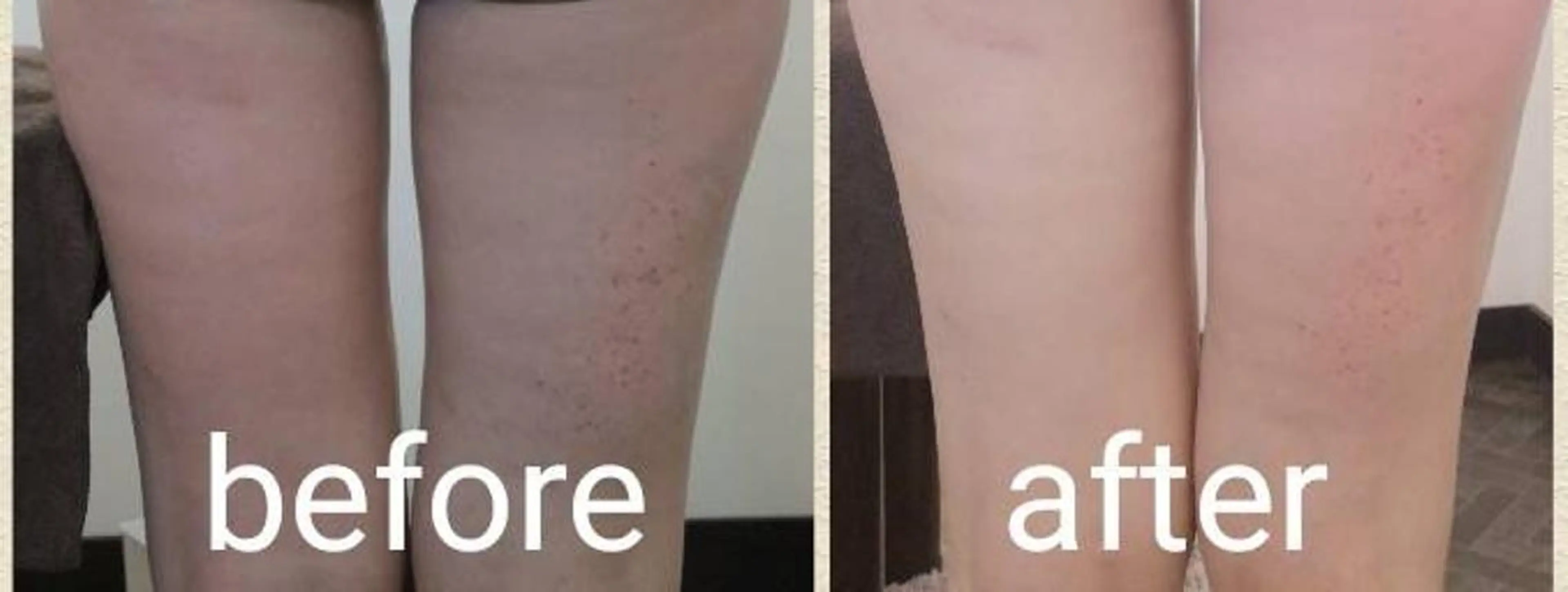 🅖🅤🅩🅔🅛 salonのエステ・リラクイメージ