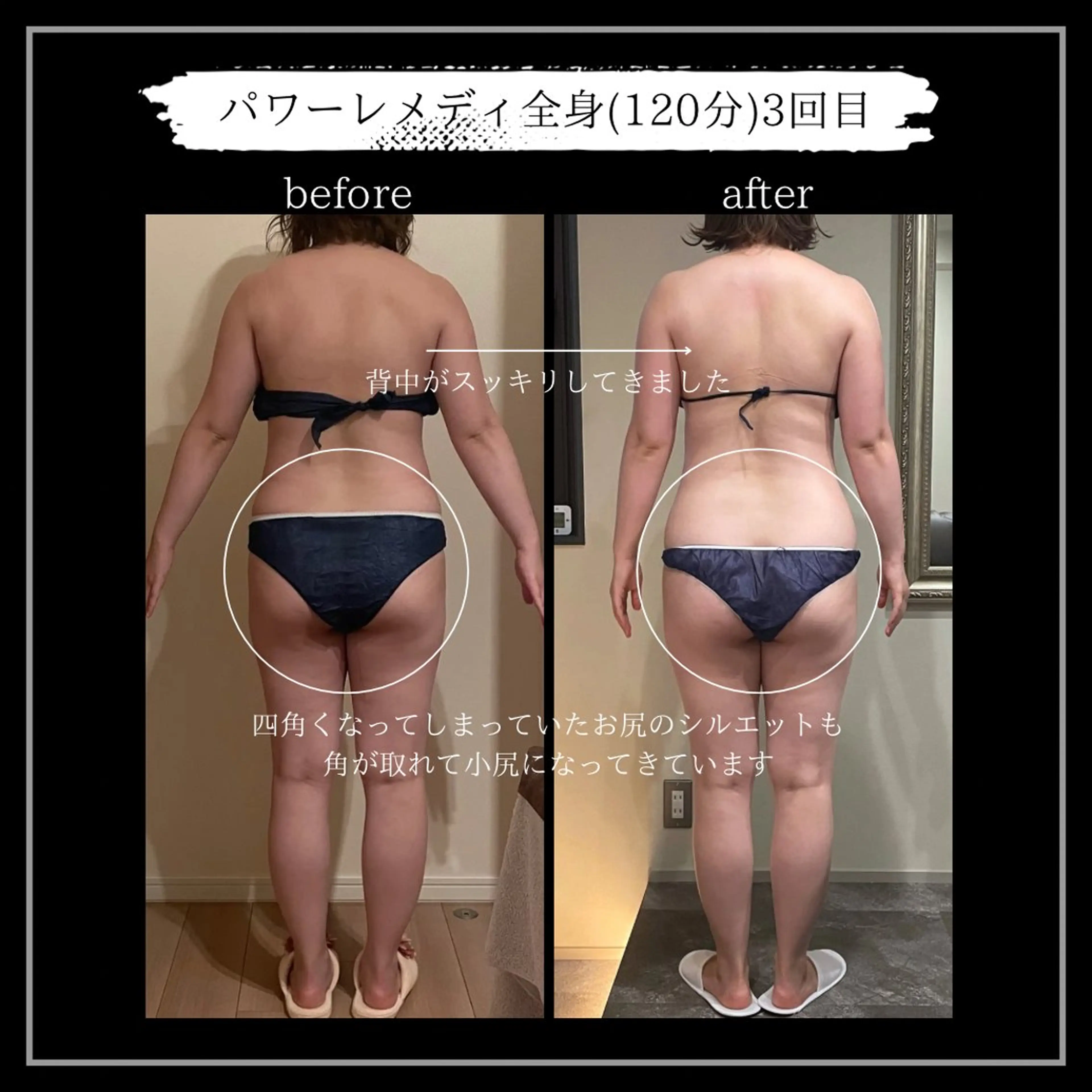 オフ:オン所属・オフ:オン 全身筋膜マッサージのエステ・リラクイメージ