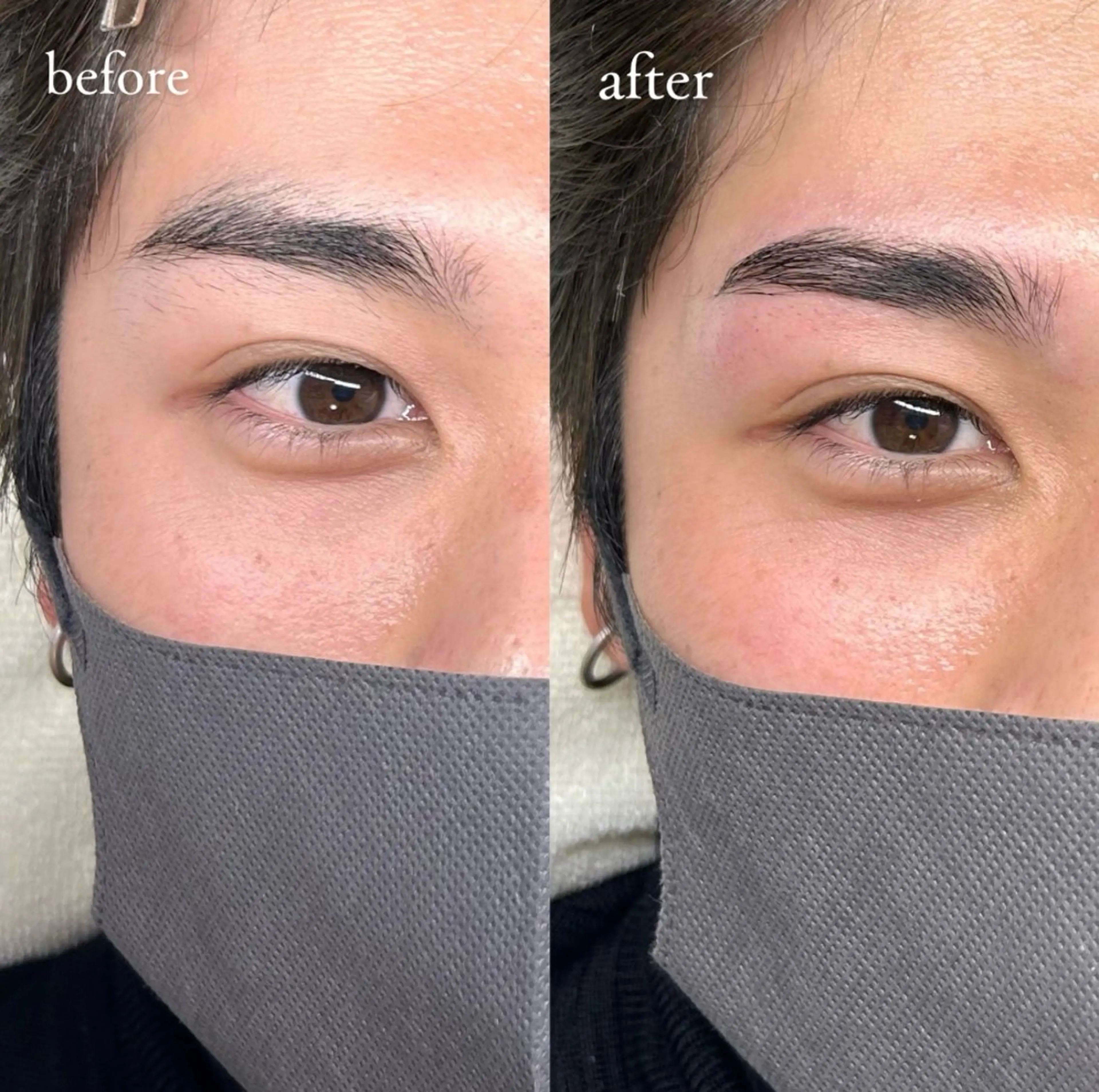 メンズ アイブロウ メンズアイブロウ アイブロウサロンTreat myself所属・Treat myselfの眉毛・アイブロウイメージ