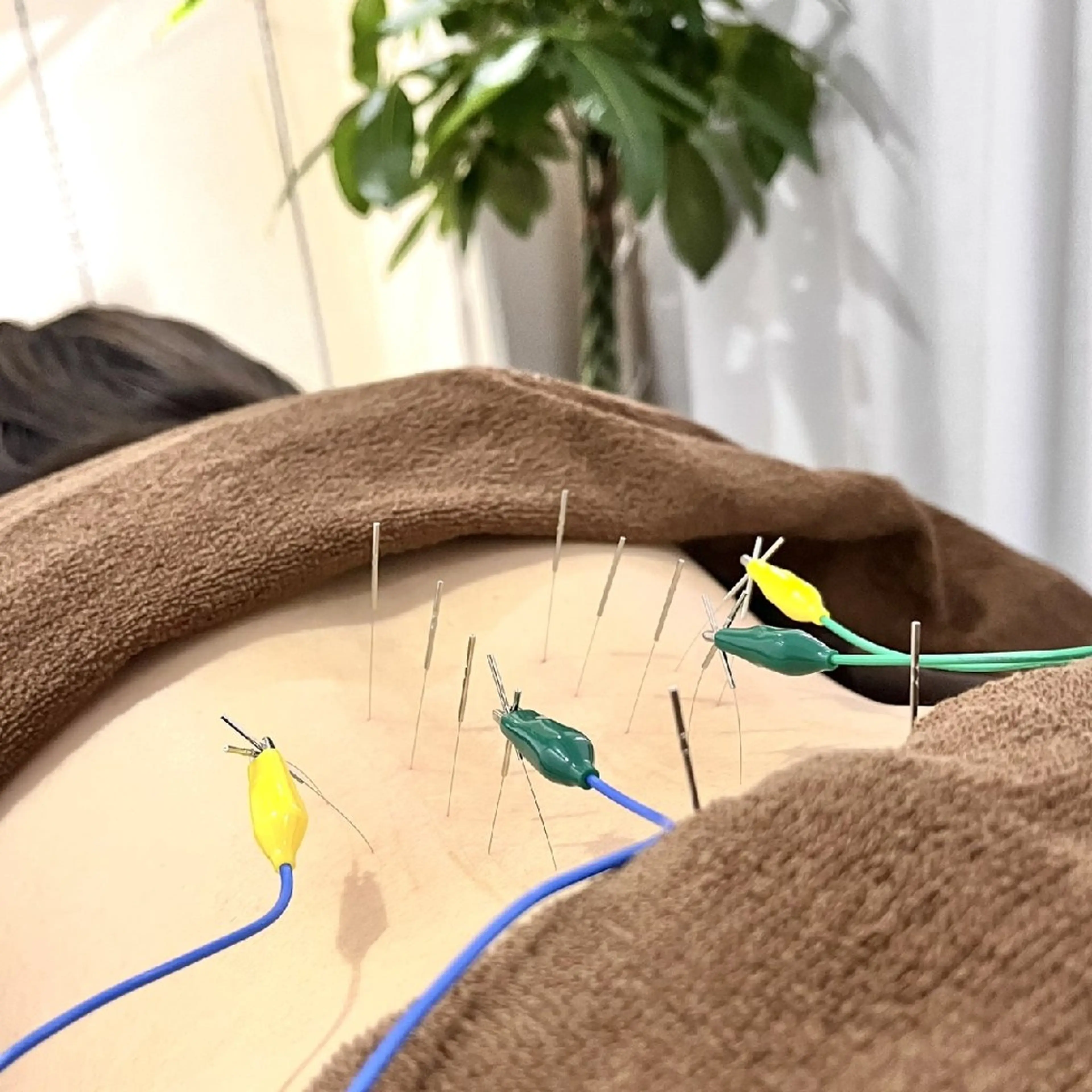 エステ リラク Spring鍼灸院所属・Spring鍼灸院 ✨首肩こり、腰痛に！のエステ・リラクイメージ