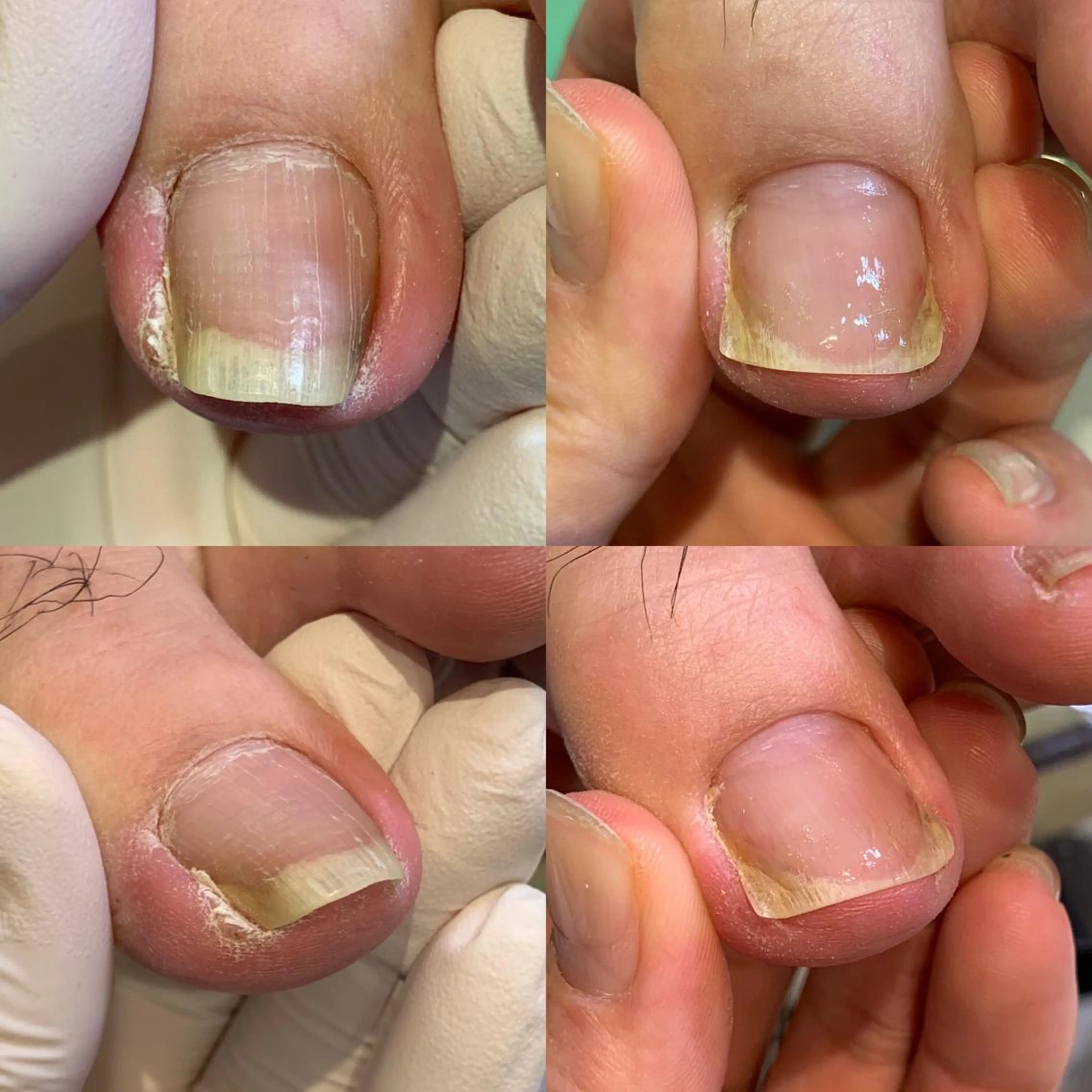 ネイル 東京巻き爪アカデミー所属・東京巻き爪 アカデミーのエステ・リラクイメージ