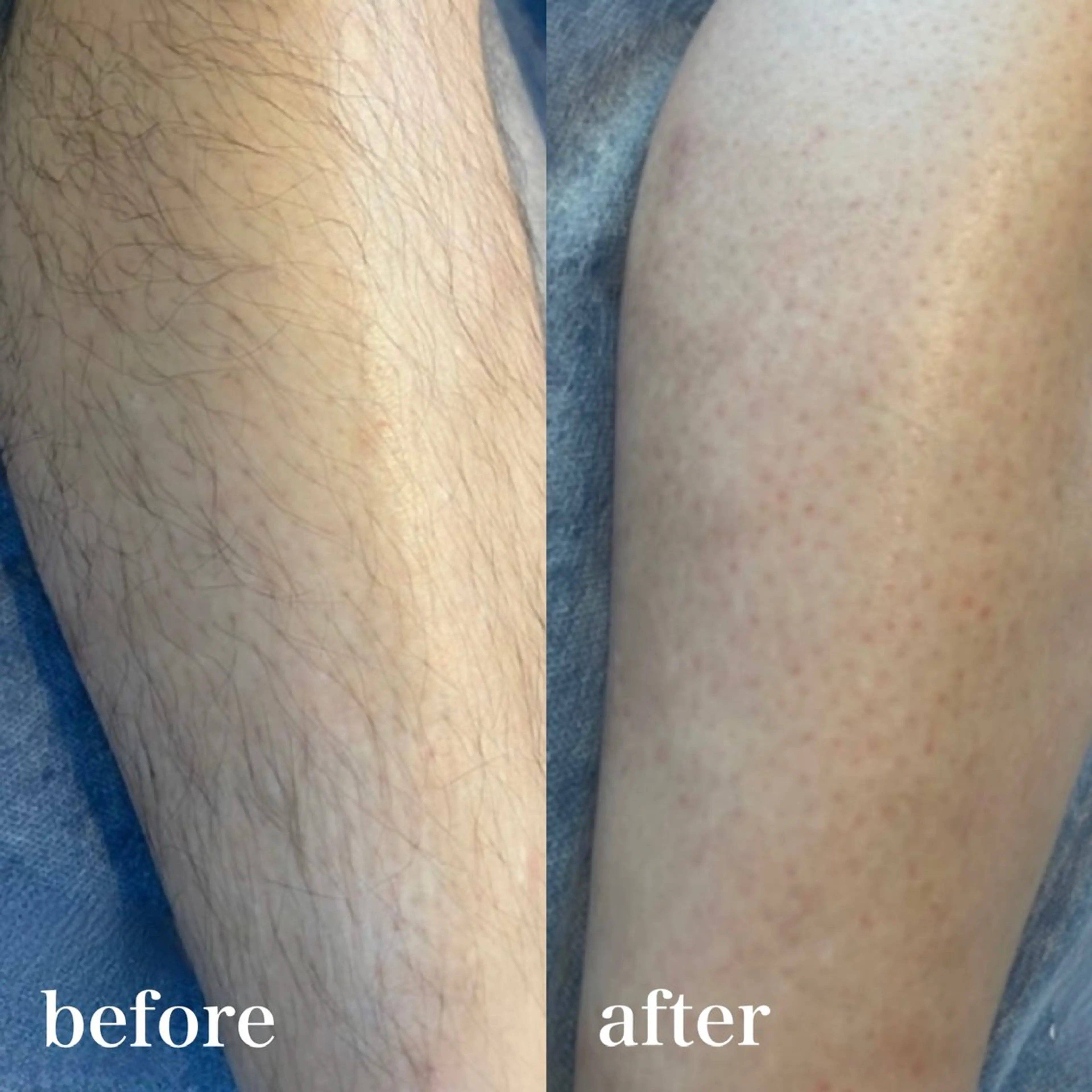 メンズ wax脱毛専門店 ハイラントのエステ・リラクイメージ