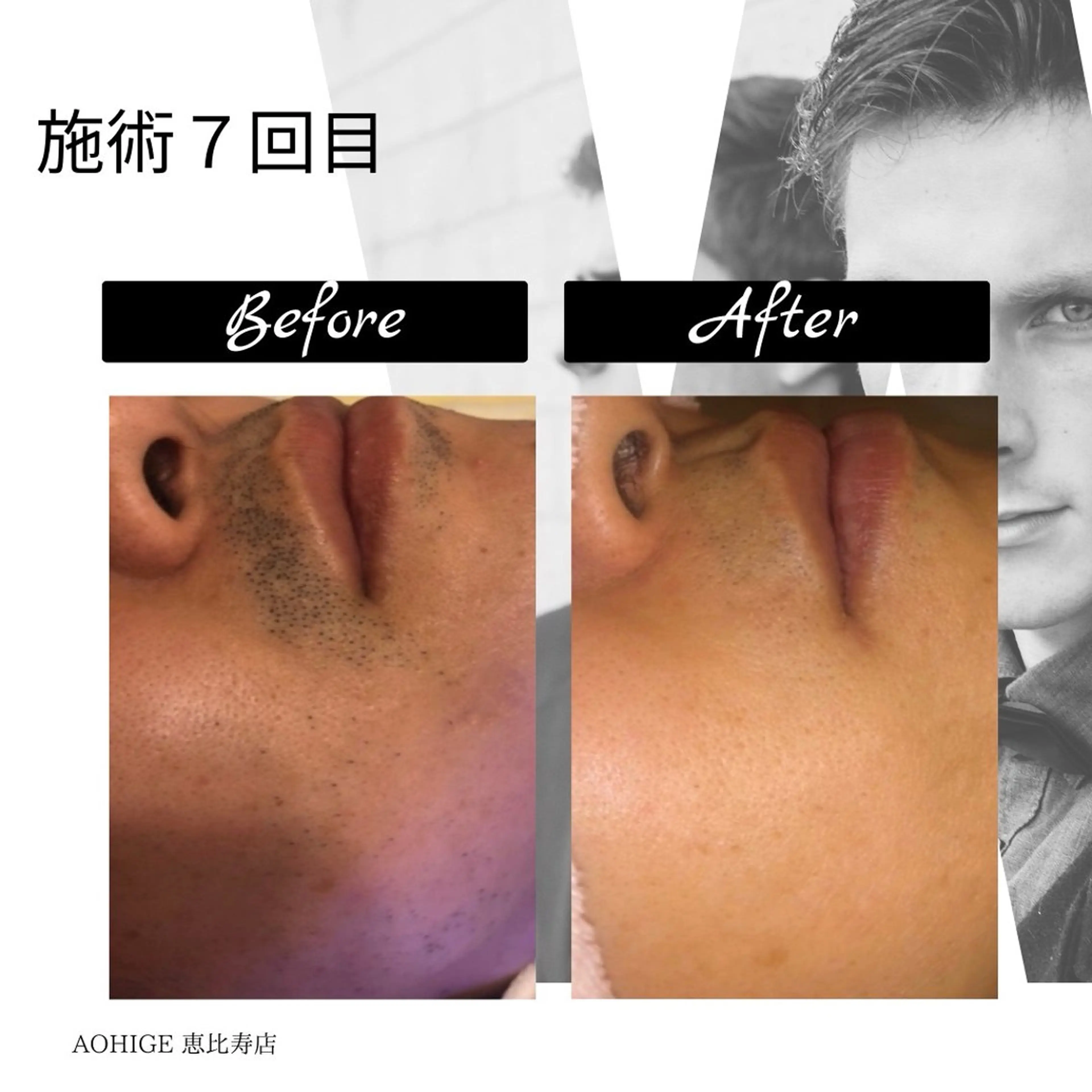 メンズ 【ena】 YUKOのマツエク・マツパデザイン