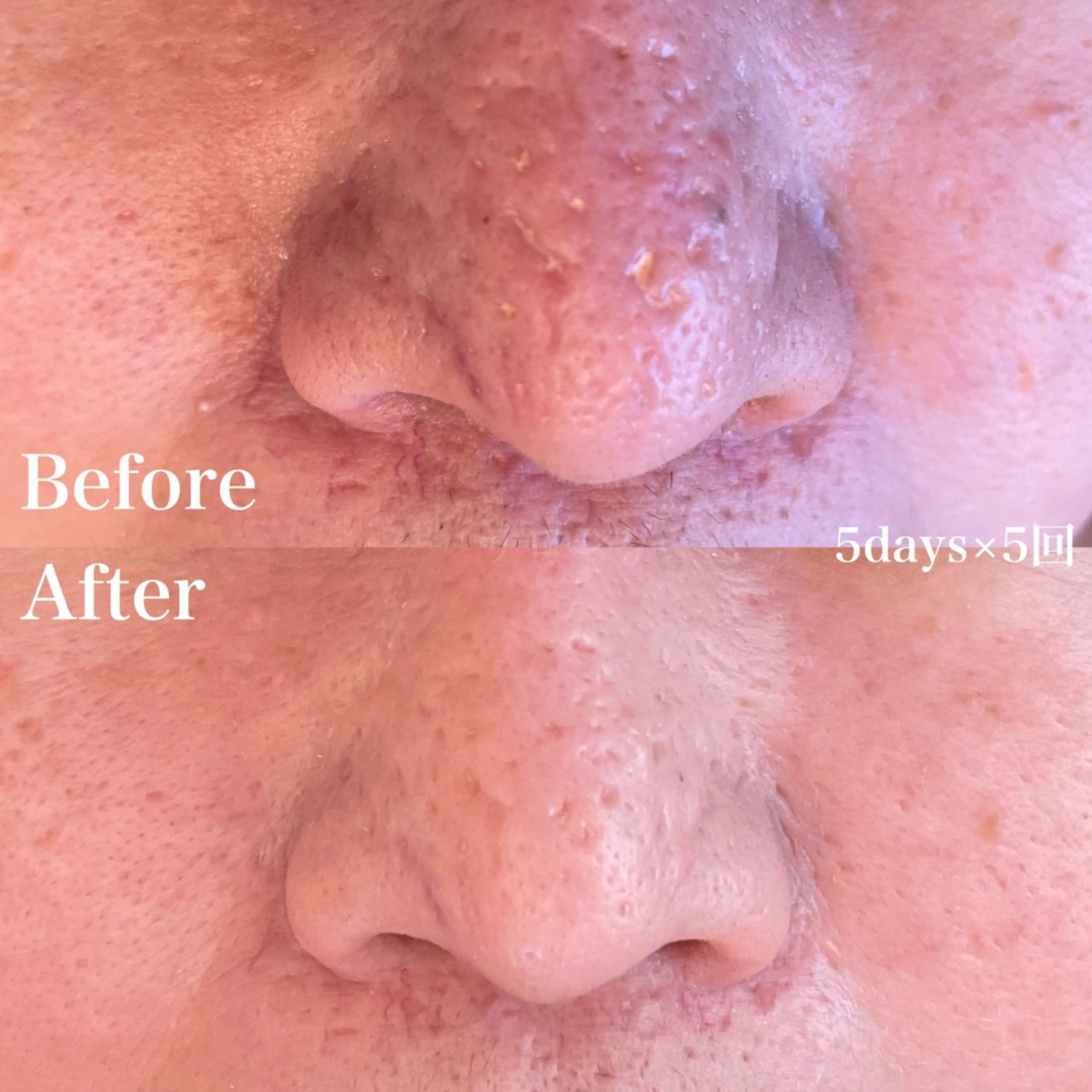 エステ リラク グリーンピール専門店 サロンY【大阪】のエステ・リラクイメージ