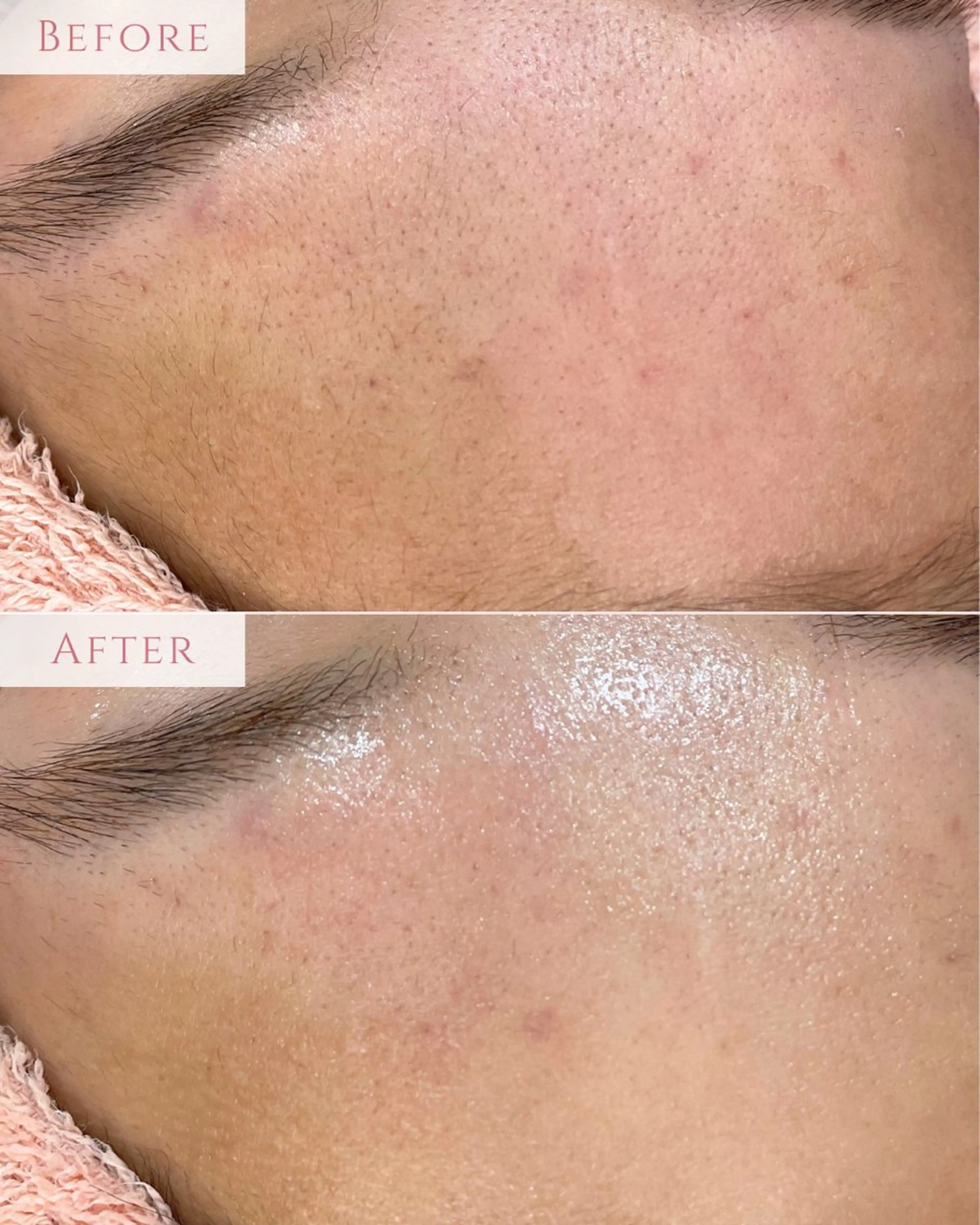 脱毛 肌質改善専門サロン Bellmi/心斎橋のエステ・リラクイメージ