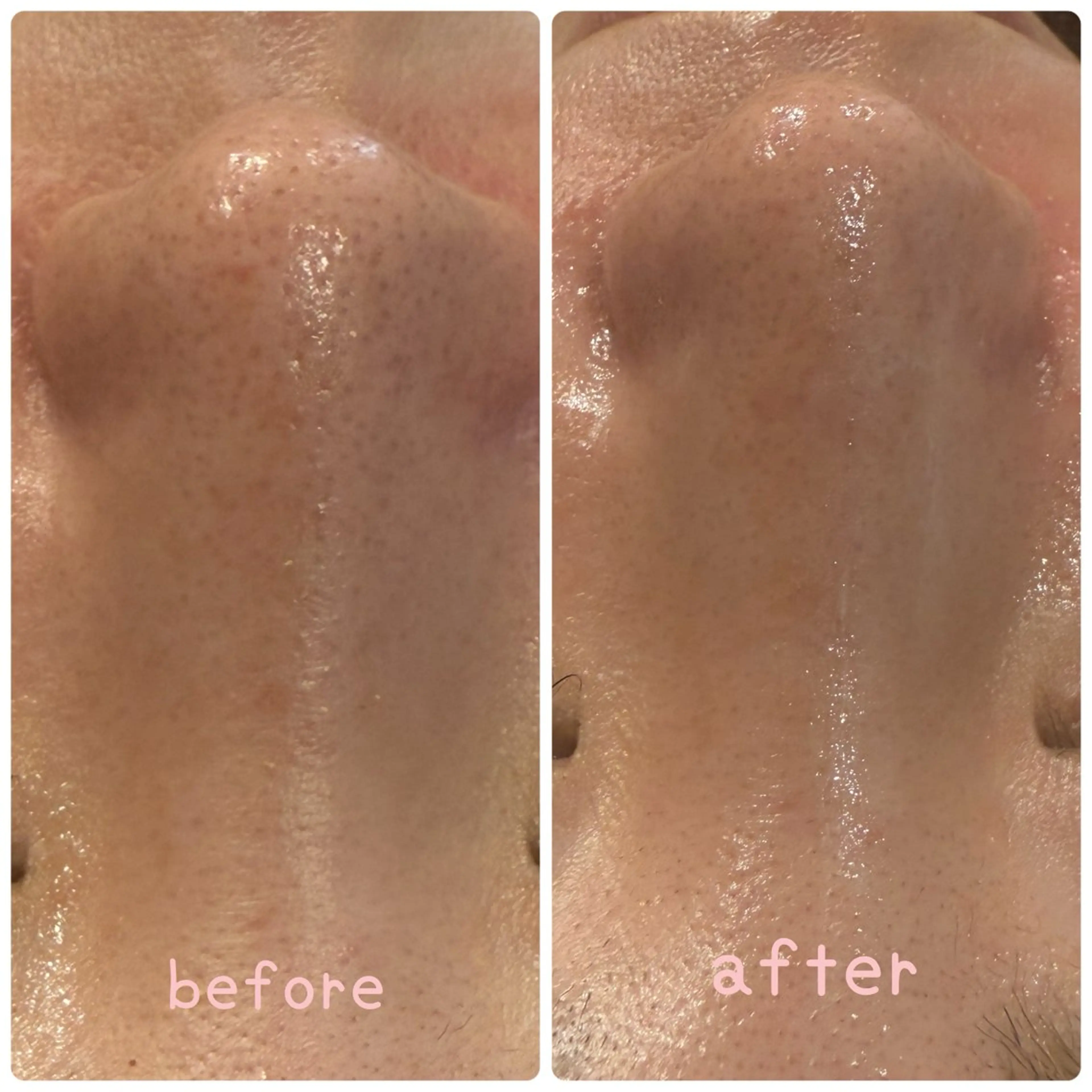 Cocofran/ manatsuのエステ・リラクイメージ