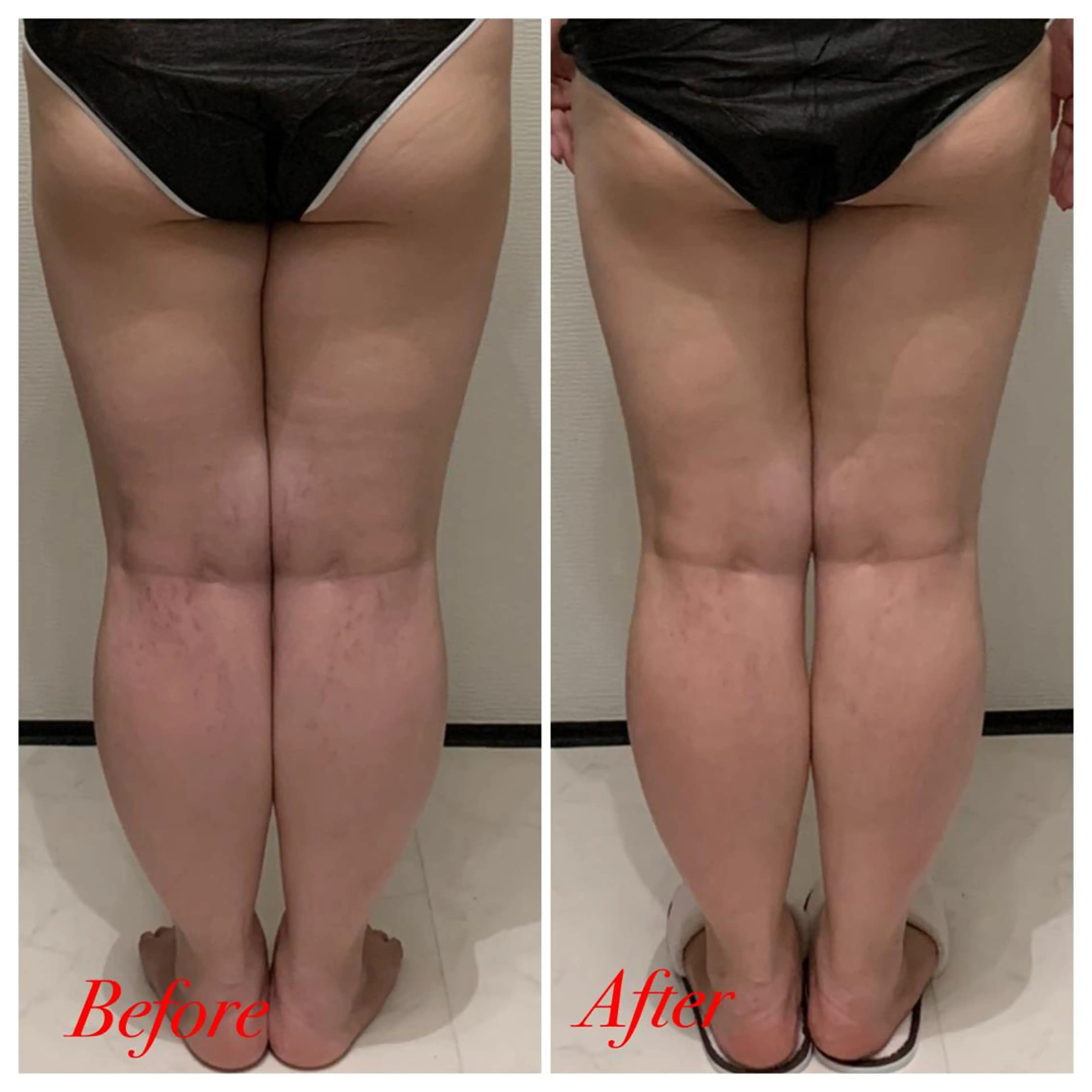 R.M所属・プライベートサロン R.Mのエステ・リラクイメージ