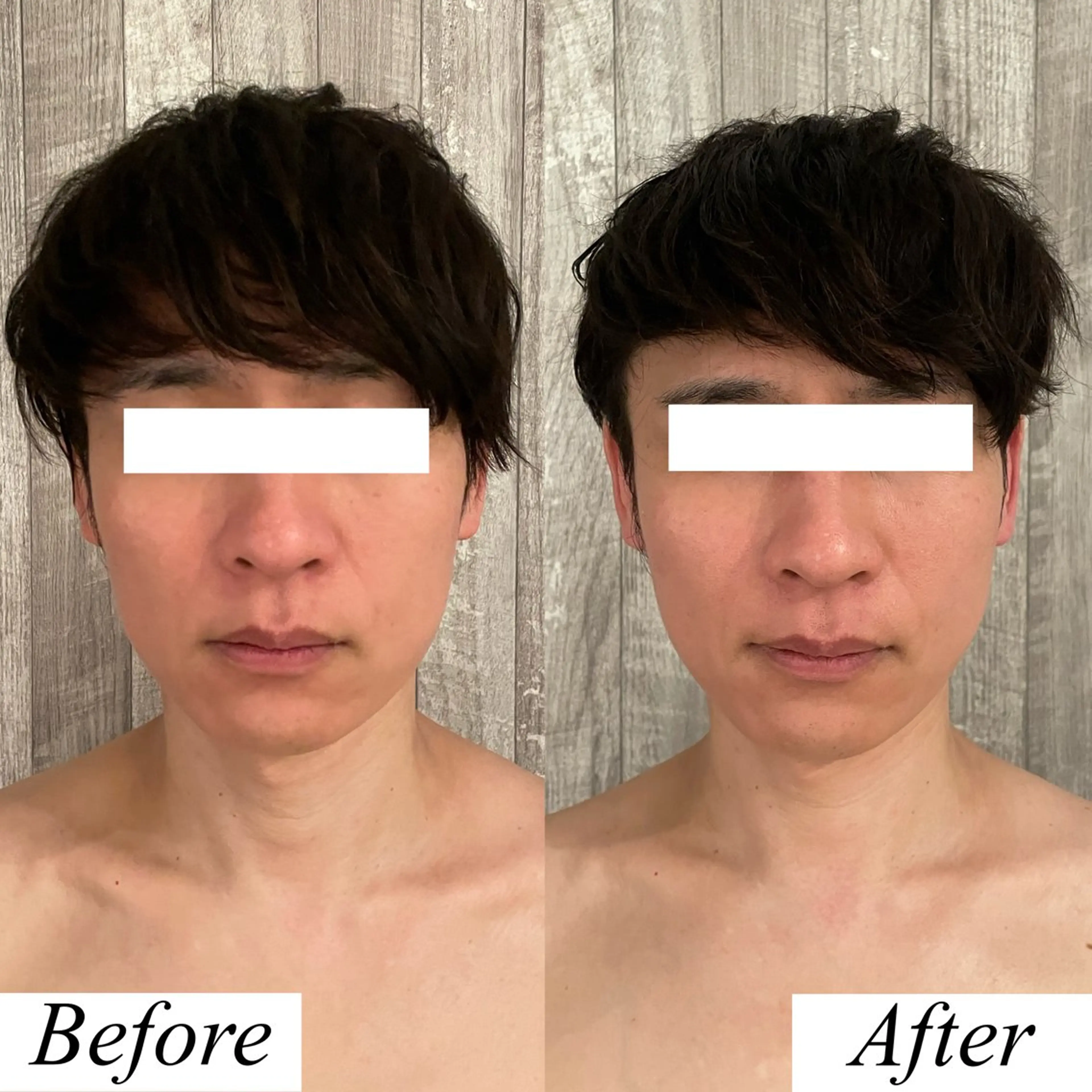 メンズ グレースフィオーレ上野御徒町店所属・頭蓋骨小顔矯正 上野御徒町店＊かんなのエステ・リラクイメージ