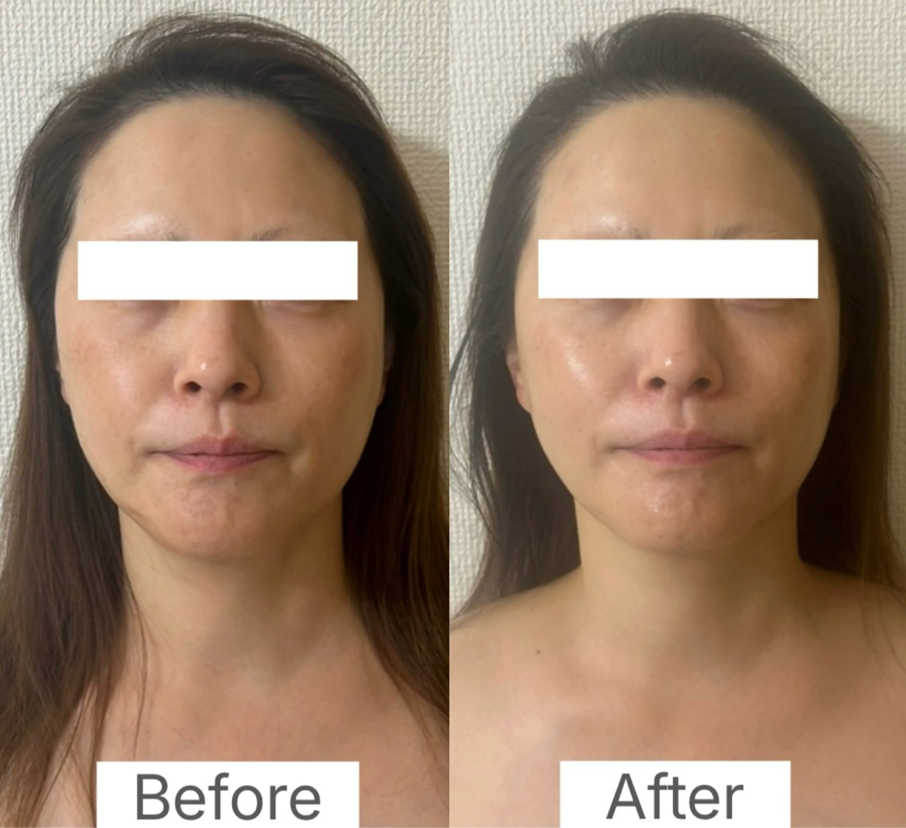 la lumie're (ラ リュミエール)所属・小顔サロン (ラ リュミエール)のエステ・リラクイメージ