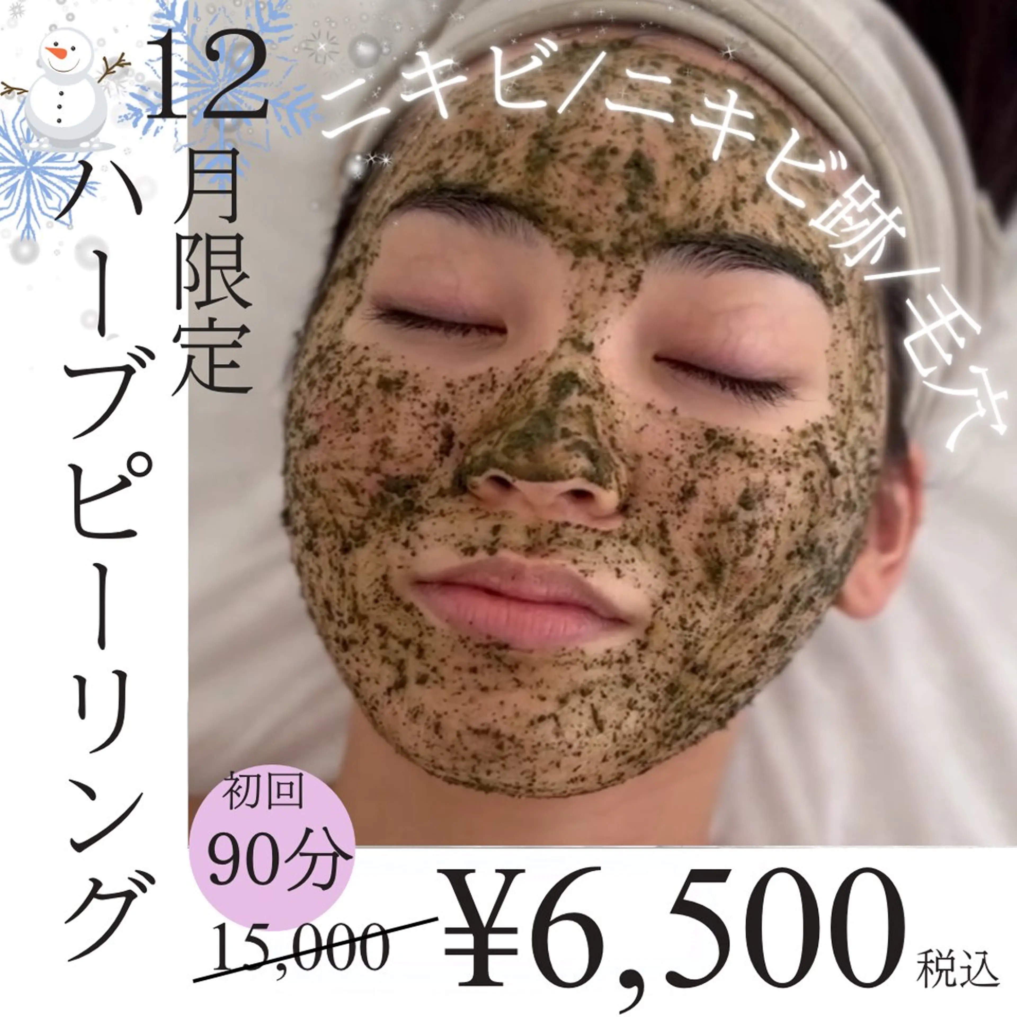 【ニキビケア】人気No.1☆ハーブピーリング🌿にきび・にきび跡・毛穴に！🉐12月限定🉐¥15,000→¥6,500の写真