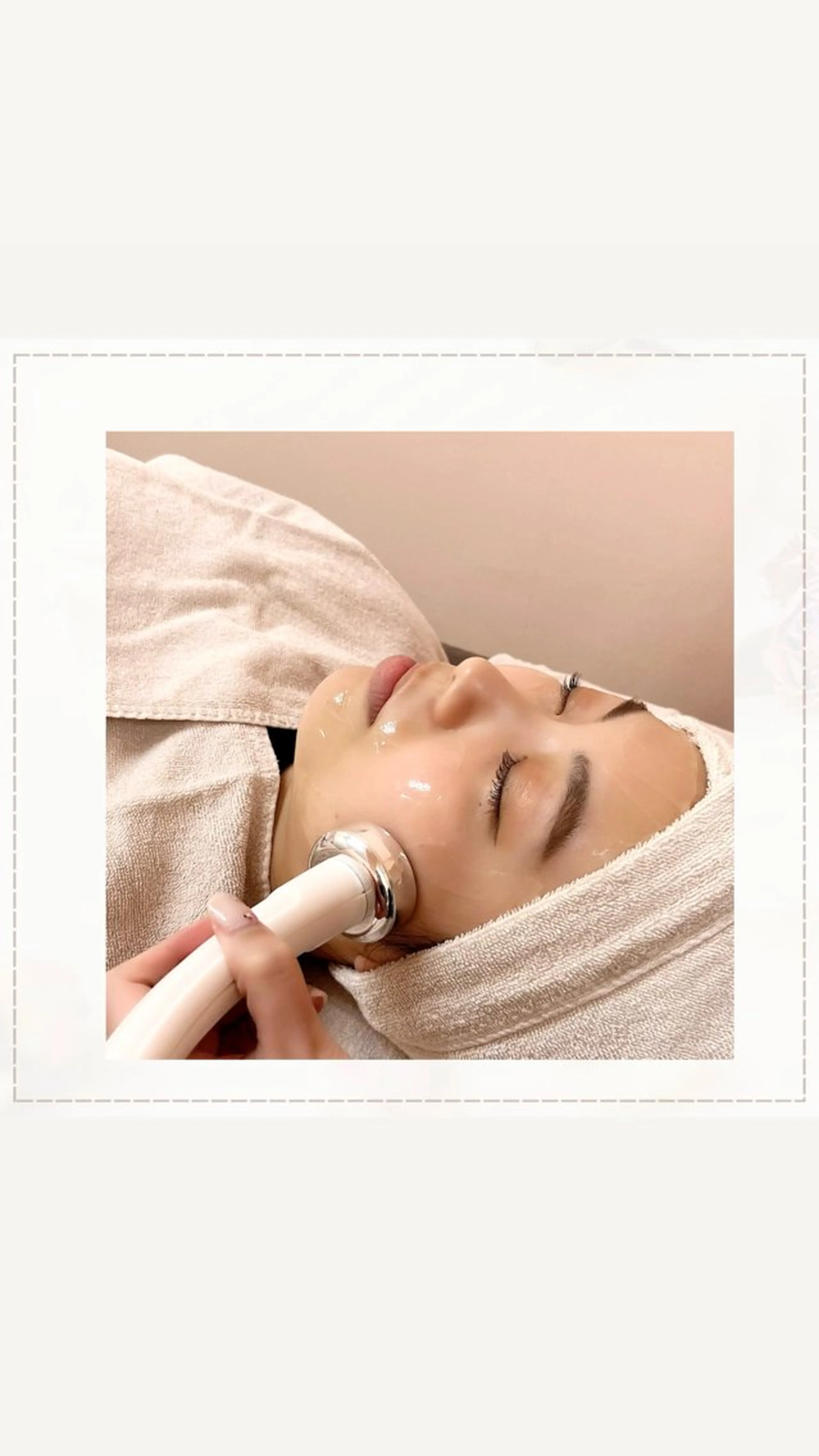 🥇毛穴・黒ずみ・繰り返しの肌荒れ予防！超音波毛穴クレンジング【脱毛体験チケット付き🎫】の写真