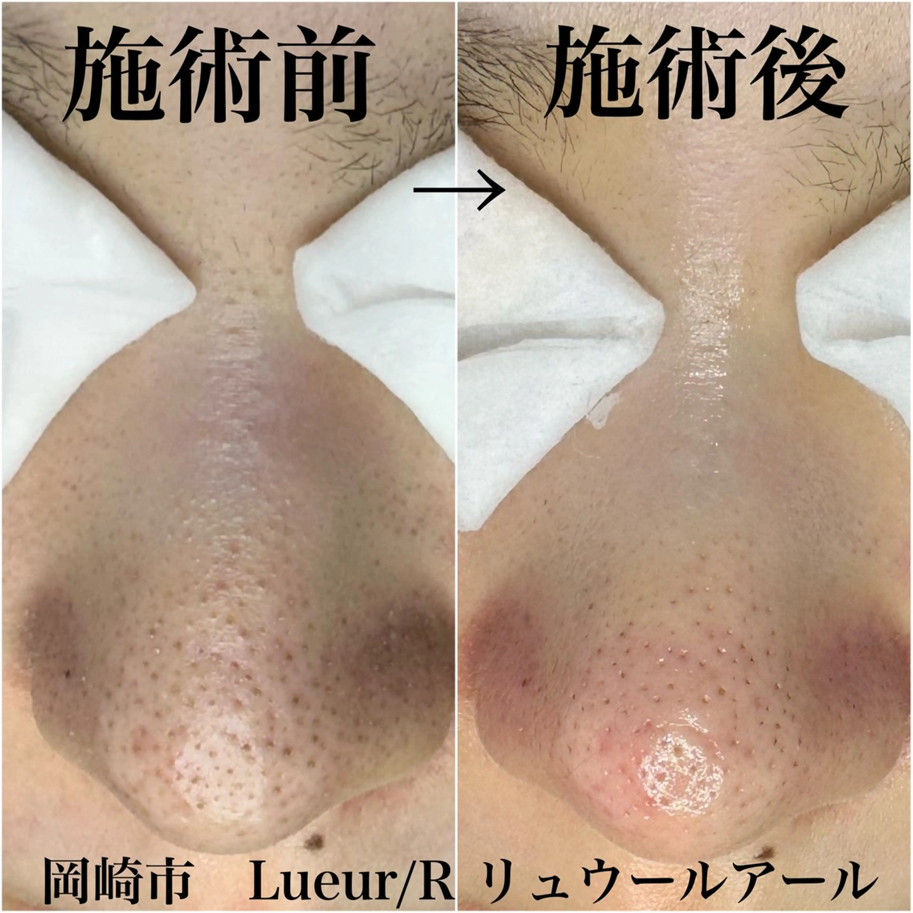 エステ 大久保 里奈のエステ・リラクイメージ