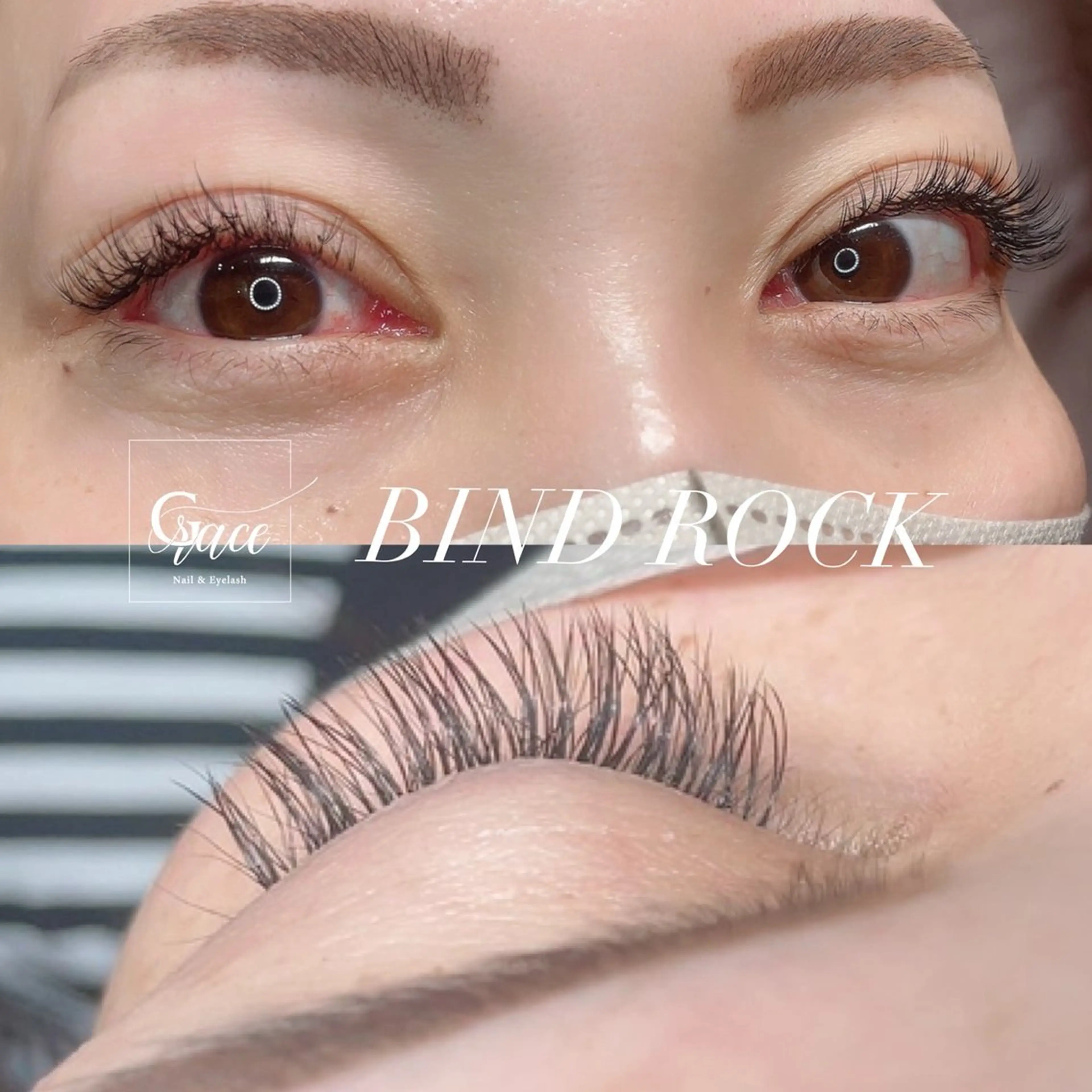 バインドロック《240本》の写真