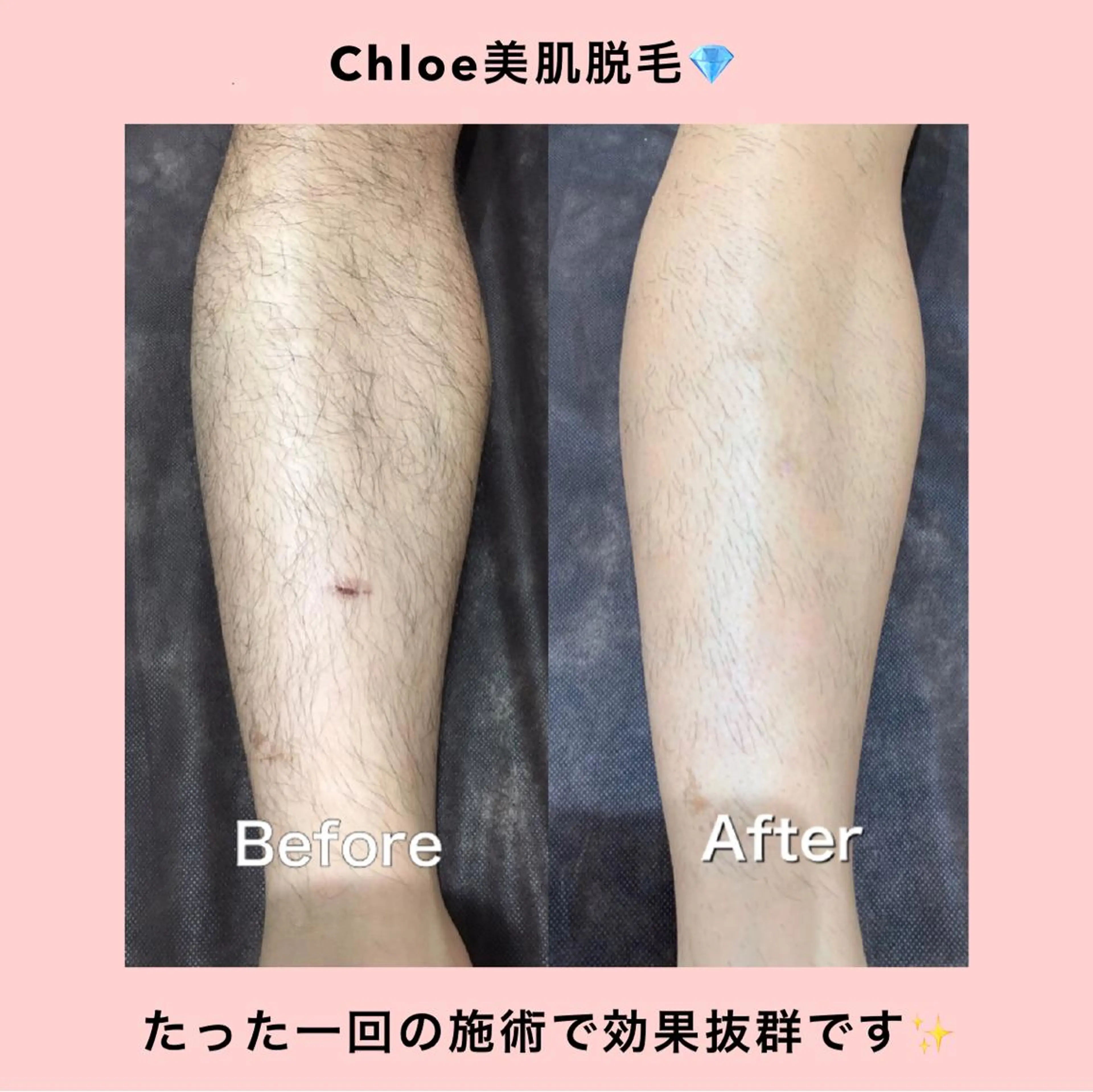 セミロング カラー パーマ ヘアアレンジ メンズ キッズ ネイル マツエク・マツパ Chloe-クロエ- 脱毛/フェイシャルのエステ・リラクイメージ