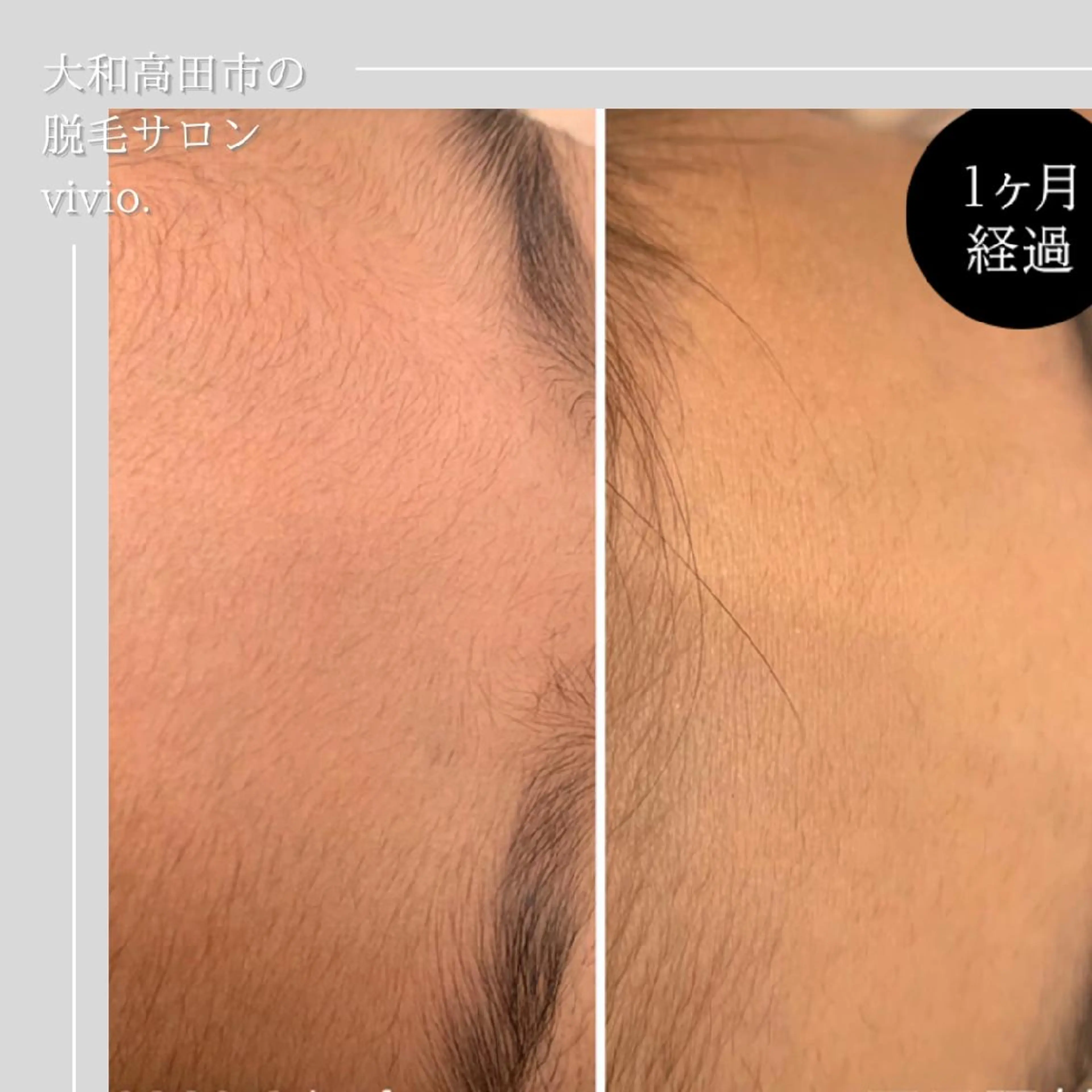 女性専用脱毛 サロンvivio.のエステ・リラクイメージ