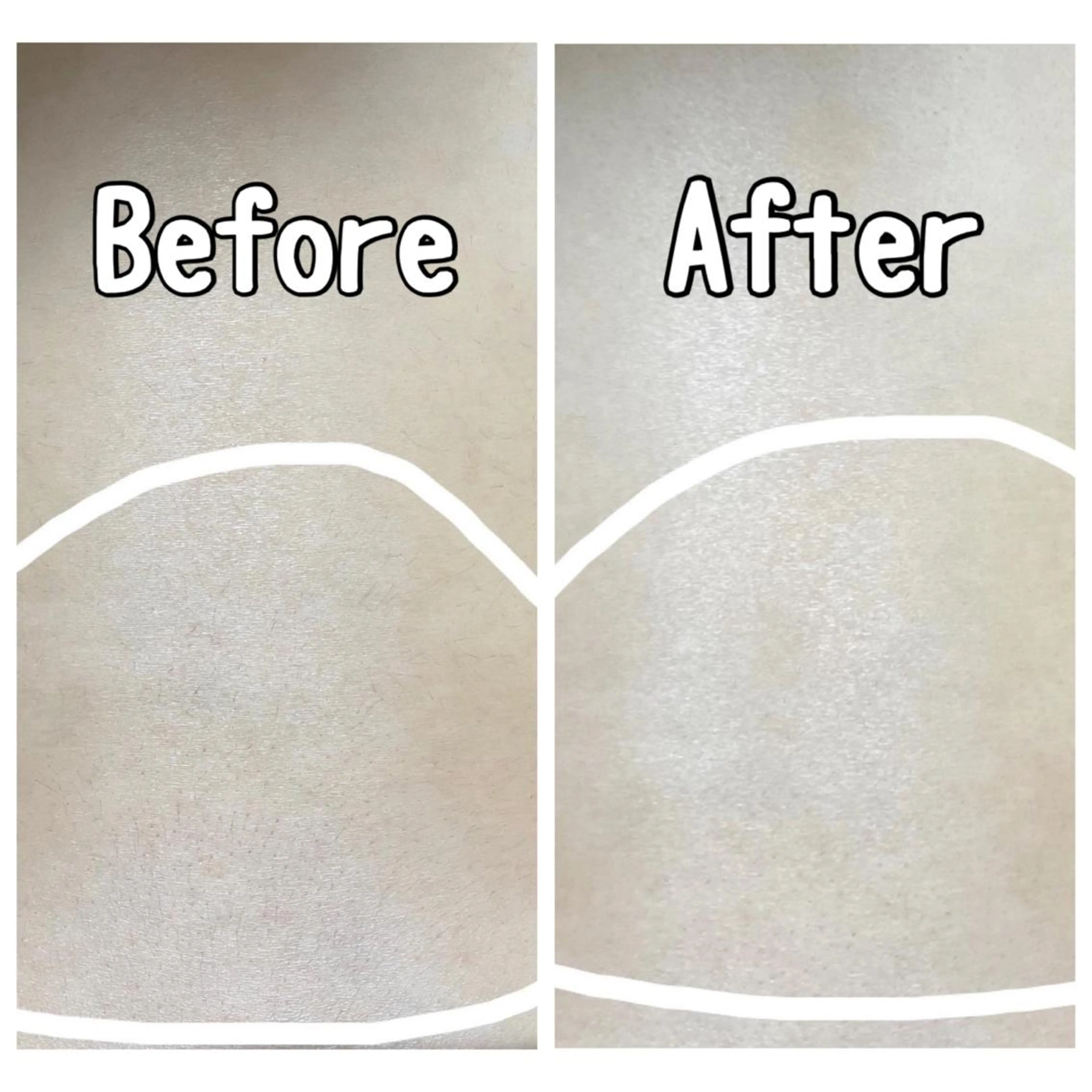 都度払い制脱毛サロンBe Charm所属・Be Charm 山﨑のエステ・リラクイメージ