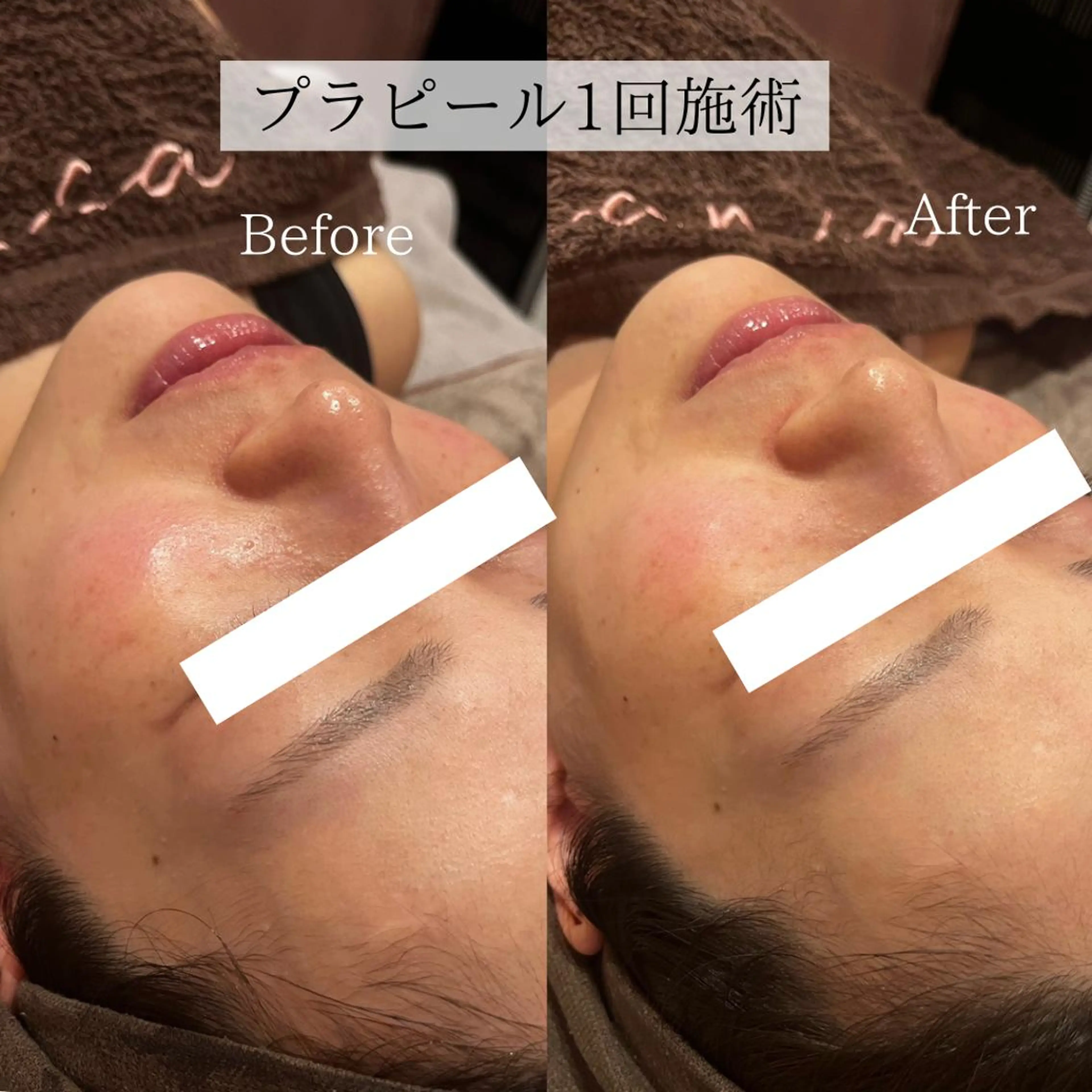 エステ 小顔美肌：ミアンカ 京阪モール本館1Fのエステ・リラクイメージ