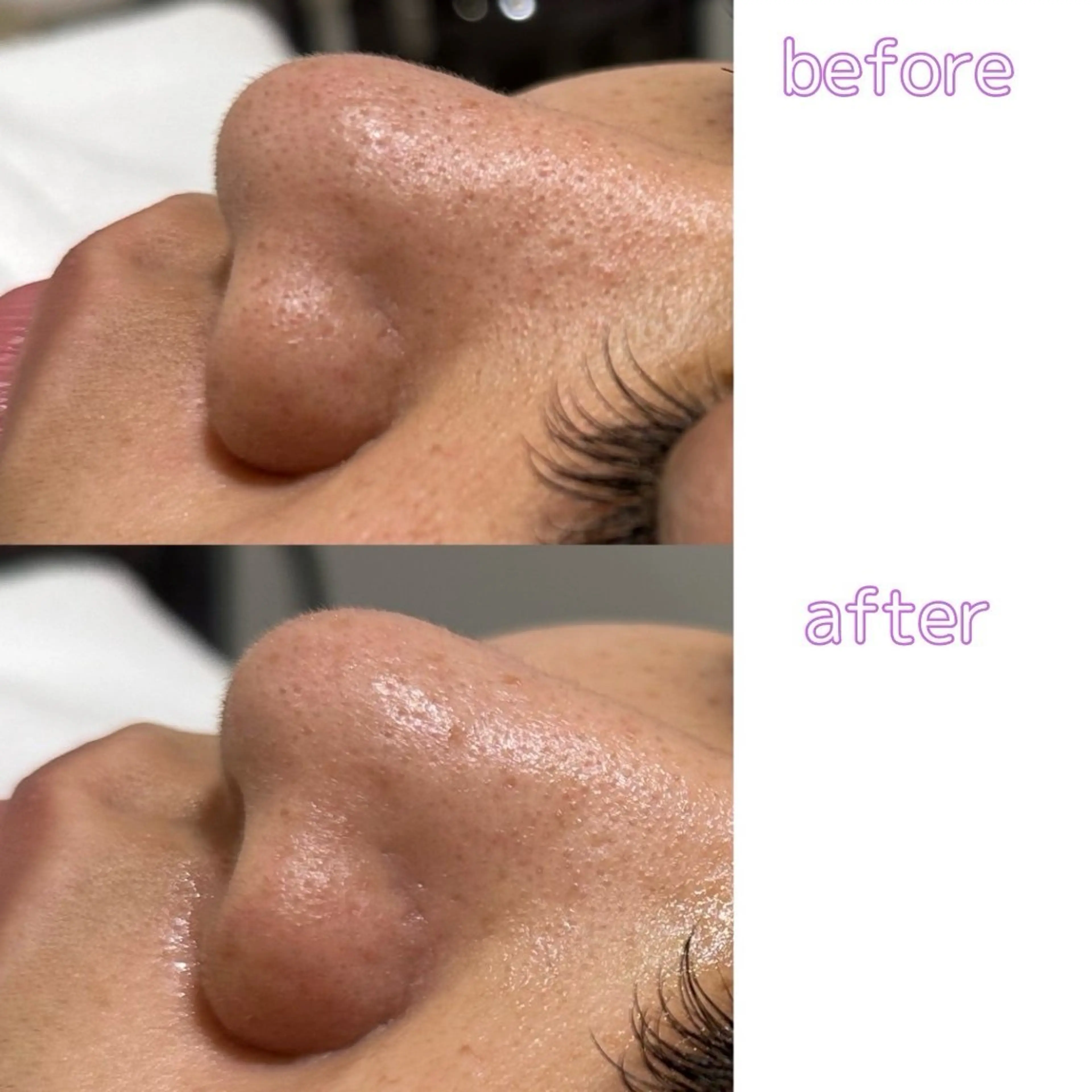 肌質改善美容サロン ému 用賀のエステ・リラクイメージ