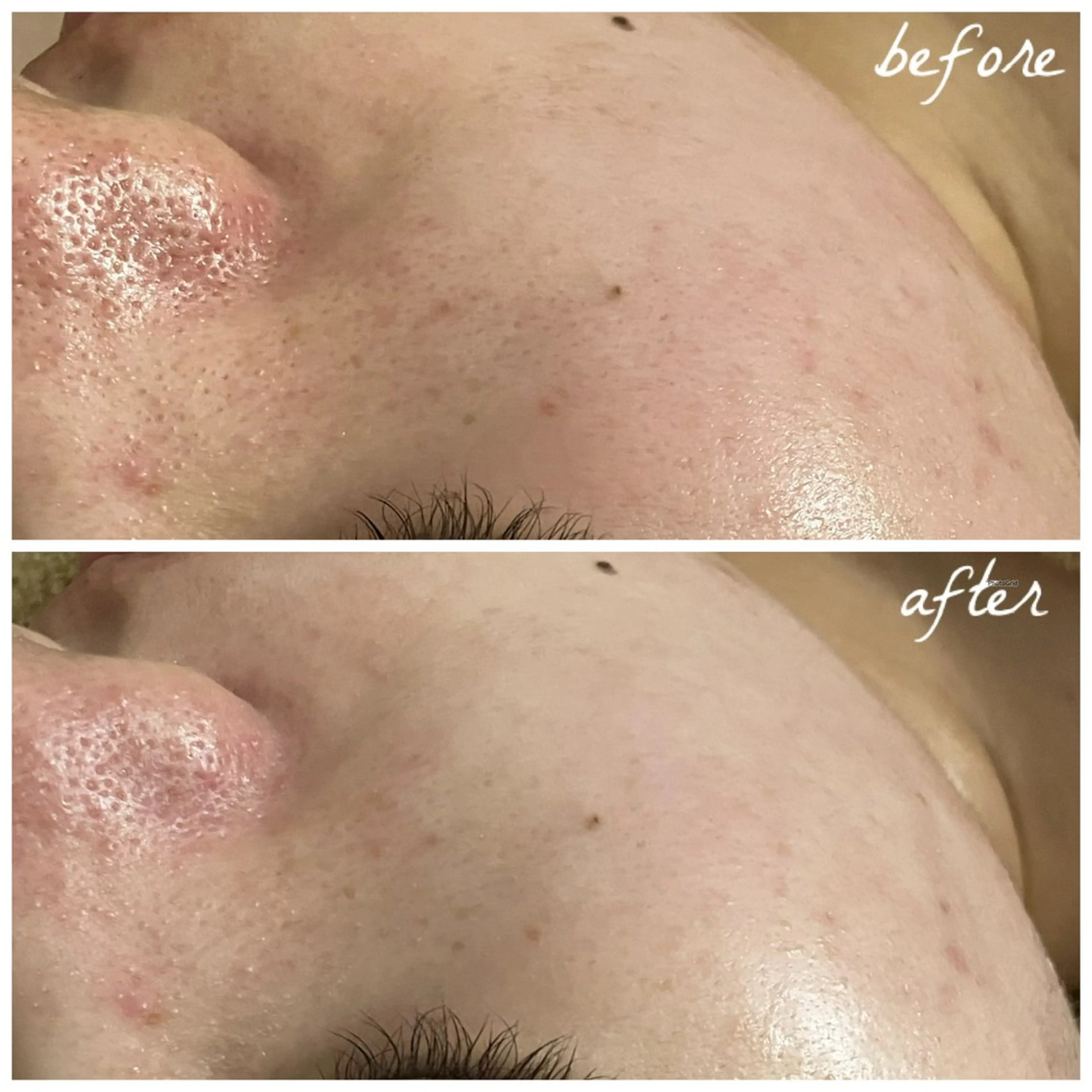 メンズ エステ メナード岐阜茜部 杉浦のエステ・リラクイメージ