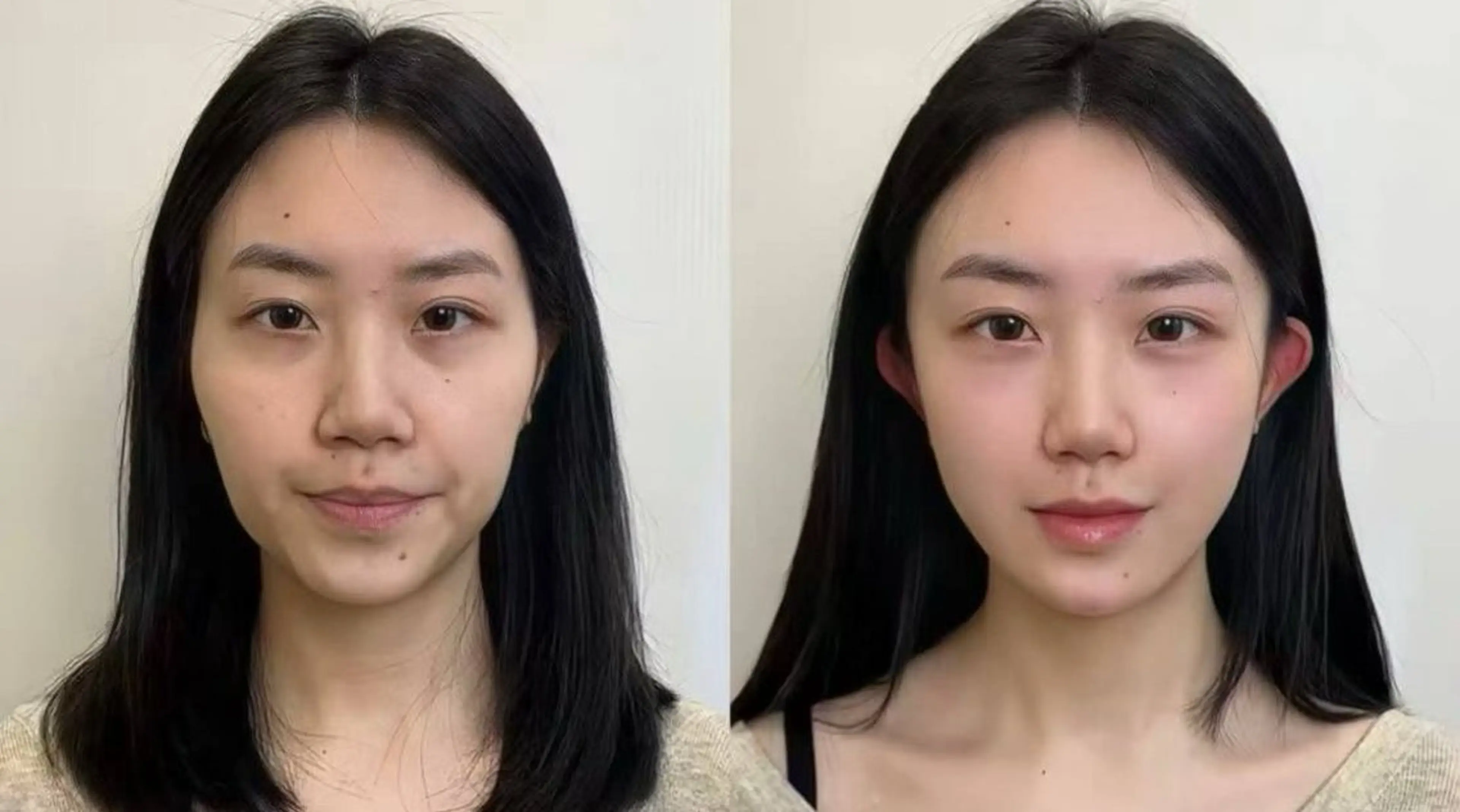 カラー エステ aliaハイフ&水光ジェットサロン所属・aliaハーブ水光店 エステティシャン募集のエステ・リラクイメージ