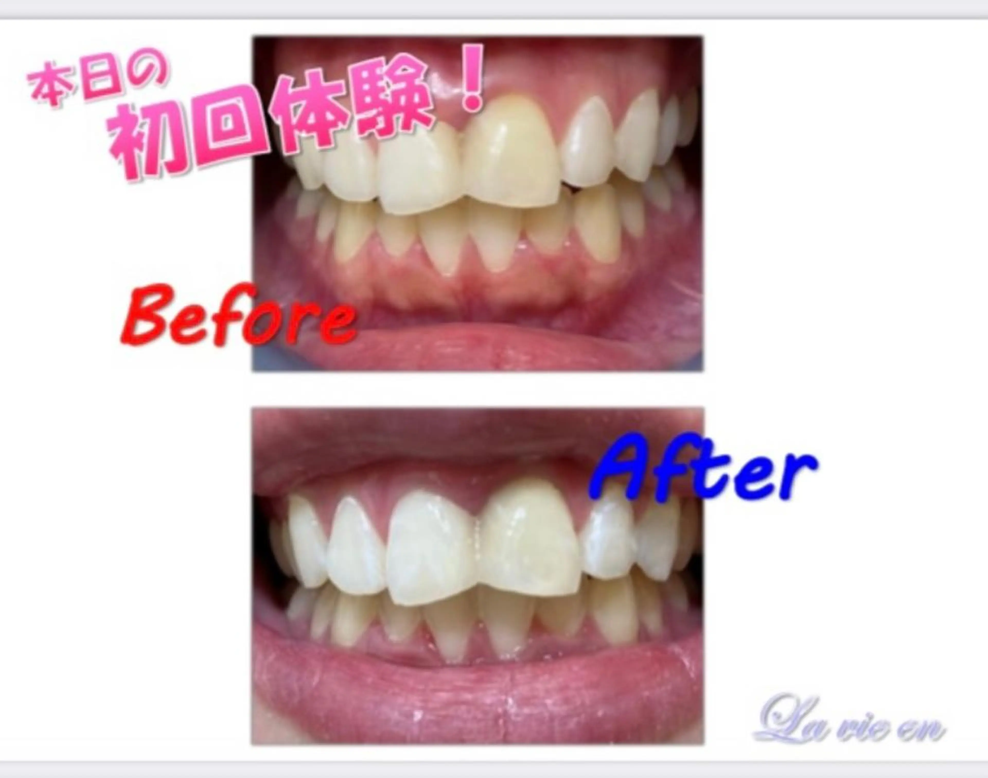 その他 セルフホワイトニングサロン　ラヴィアン所属・ホワイトニングサロン La vie enのその他イメージ