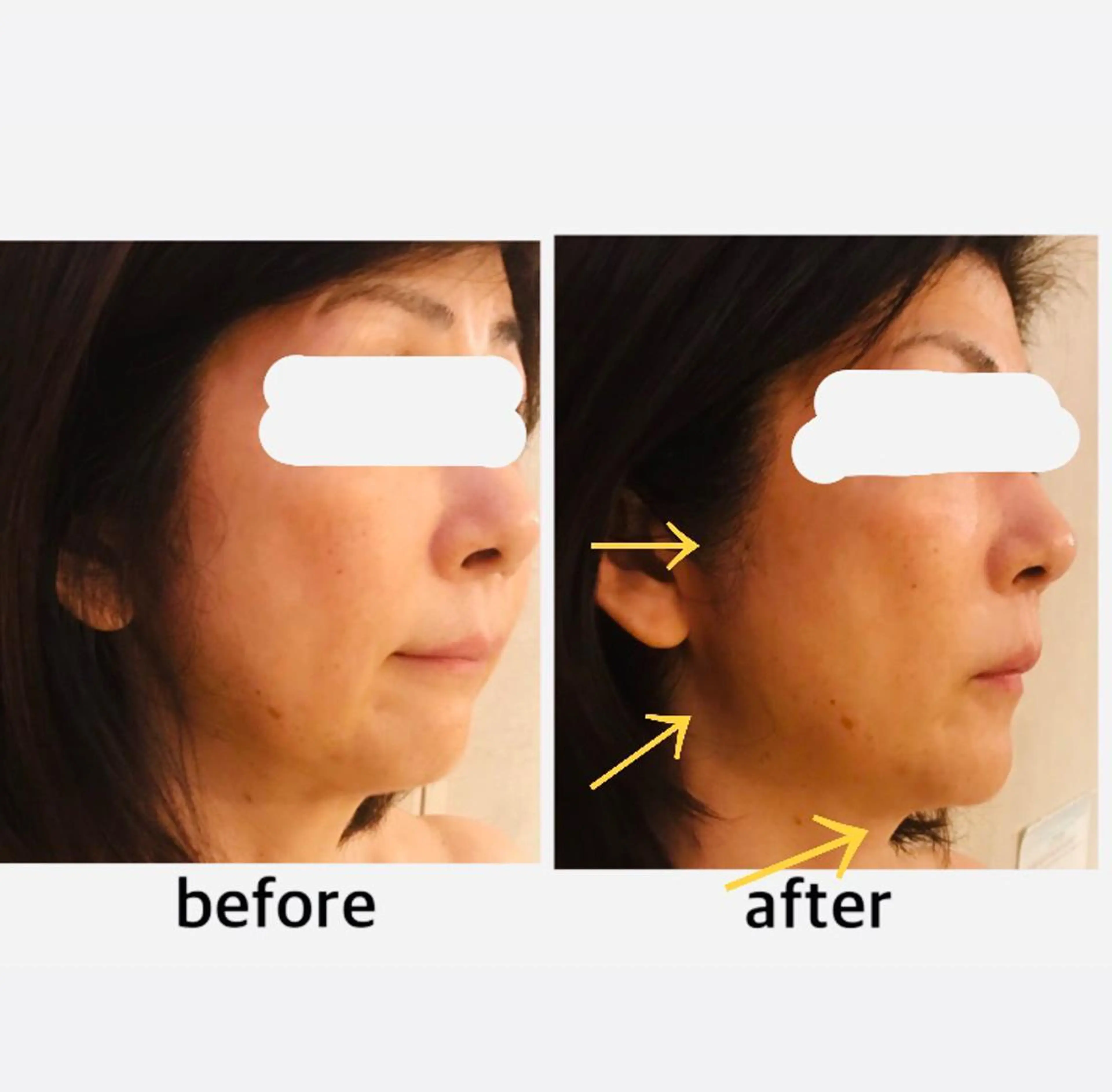 アクシア ビューティー サロン所属・究極のアンチエイ ジングサロンのエステ・リラクイメージ