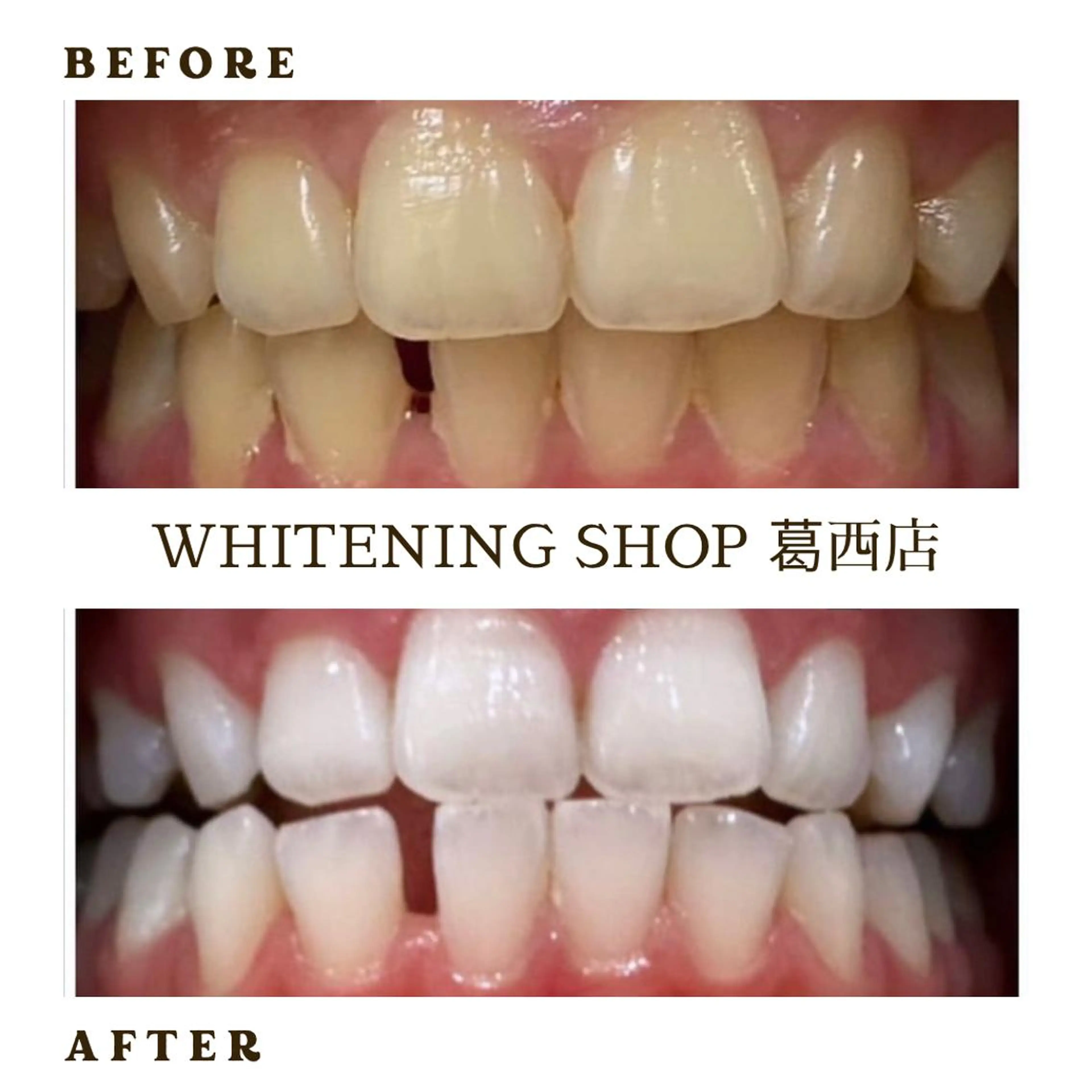 メンズ ホワイトニング ショップ葛西店のその他イメージ