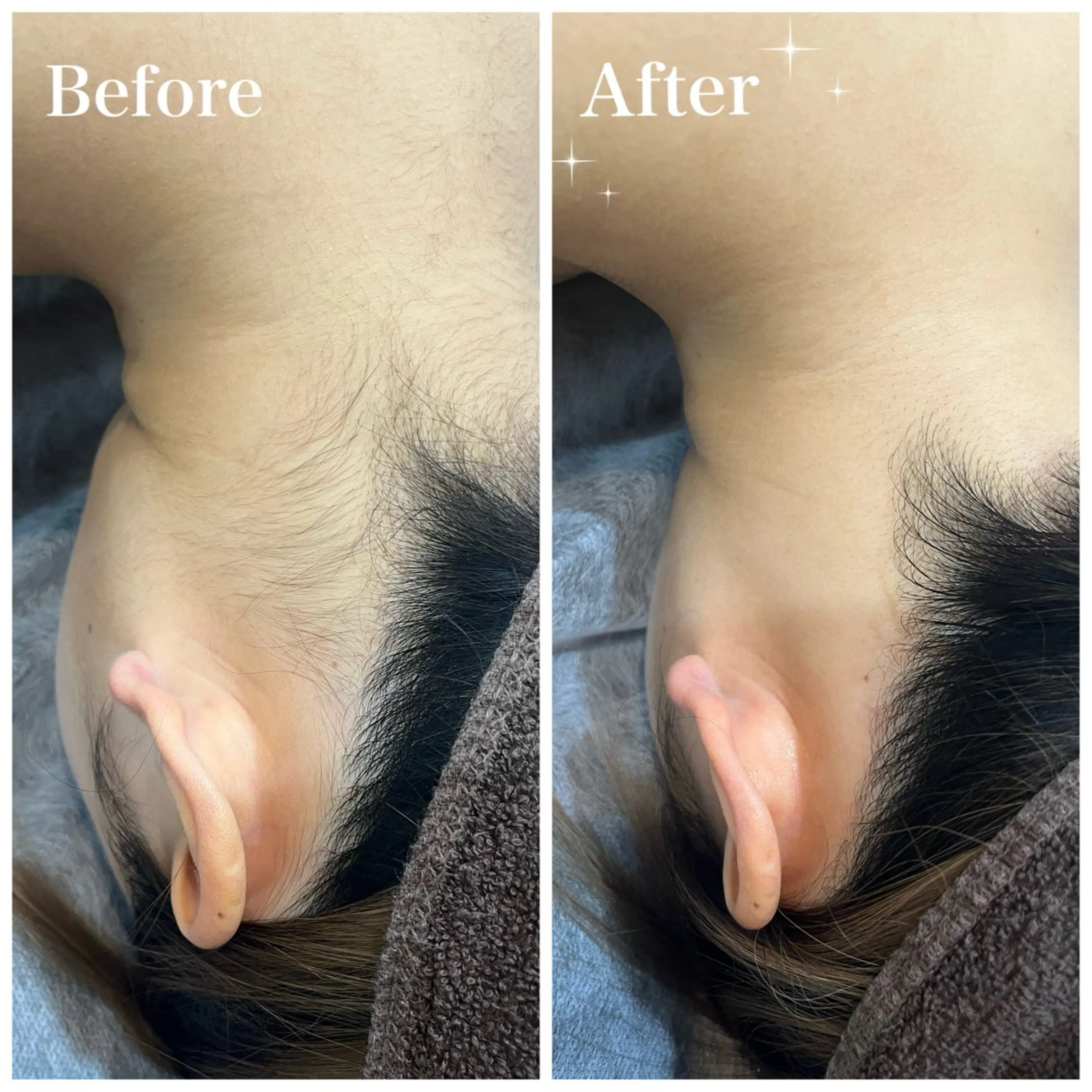 脱毛 脱毛サロン fam.豊澤柚良のエステ・リラクイメージ