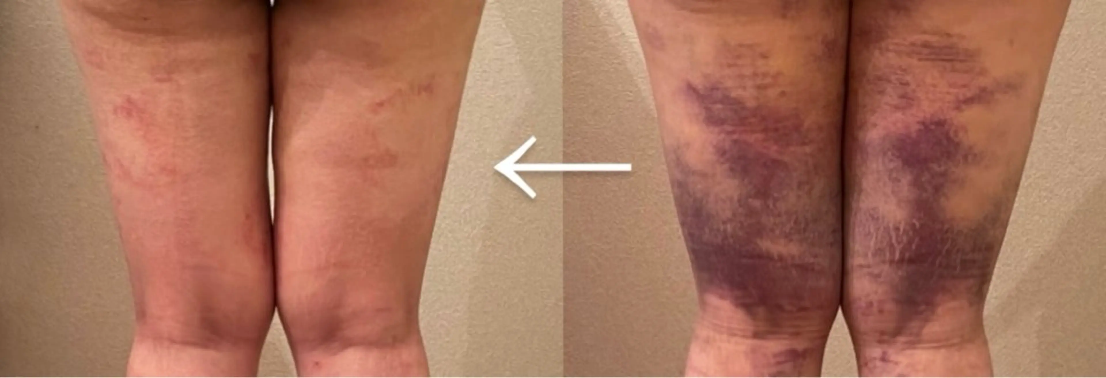 疲労回復　ぽかぽか温熱でリラックス　ボディ60分の写真