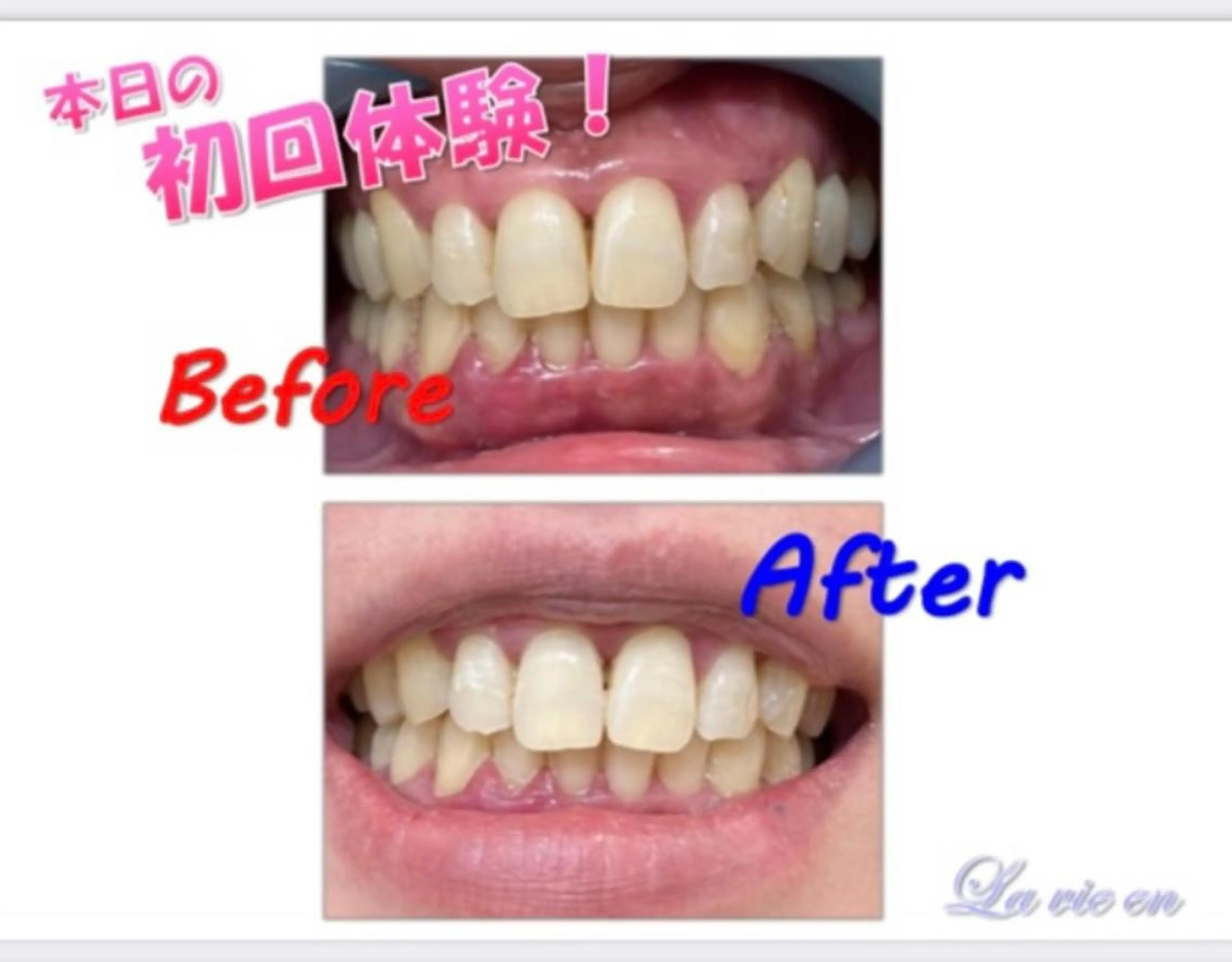 その他 セルフホワイトニングサロン　ラヴィアン所属・ホワイトニングサロン La vie enのその他イメージ