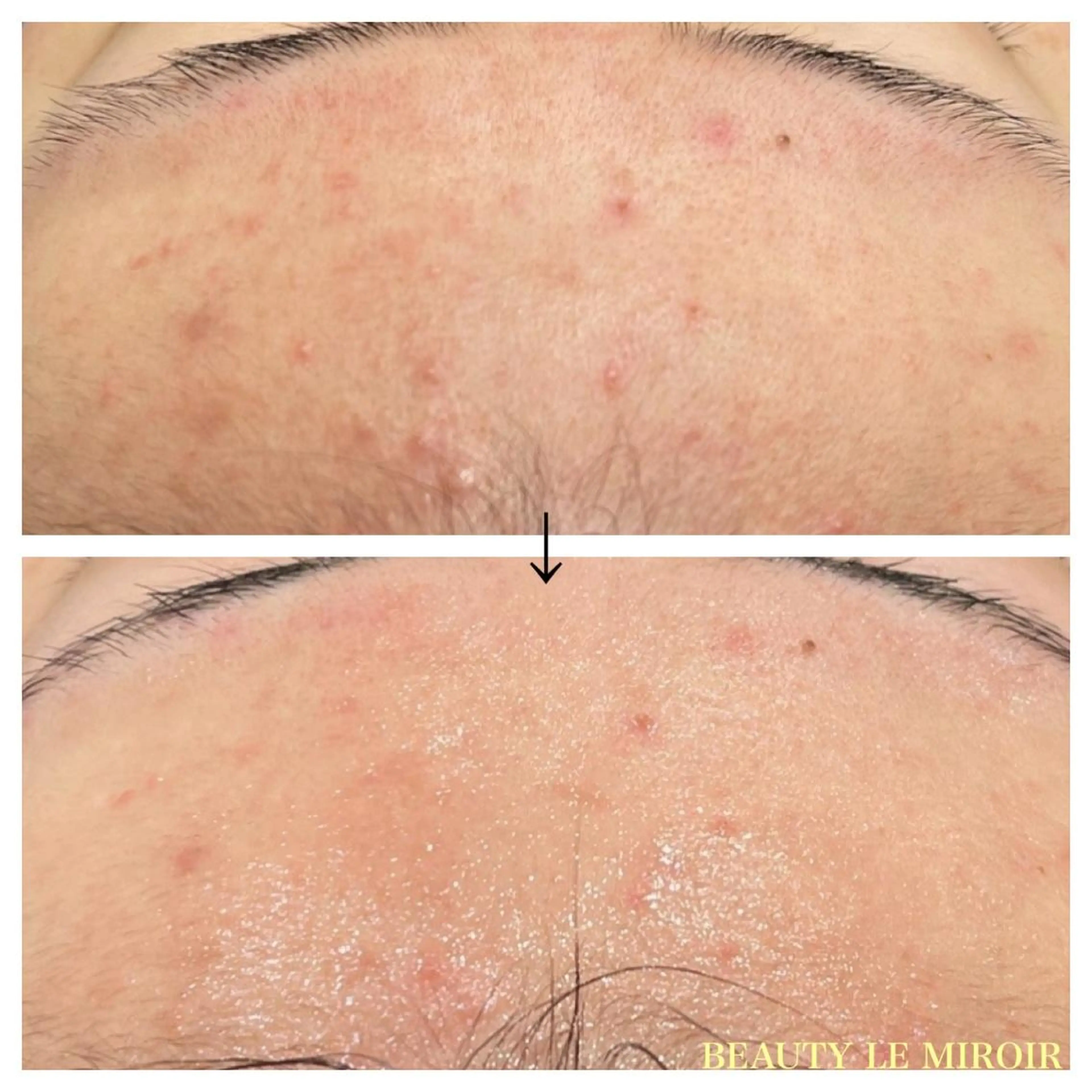 マツエク・マツパ ビューティー ミロワールのエステ・リラクイメージ