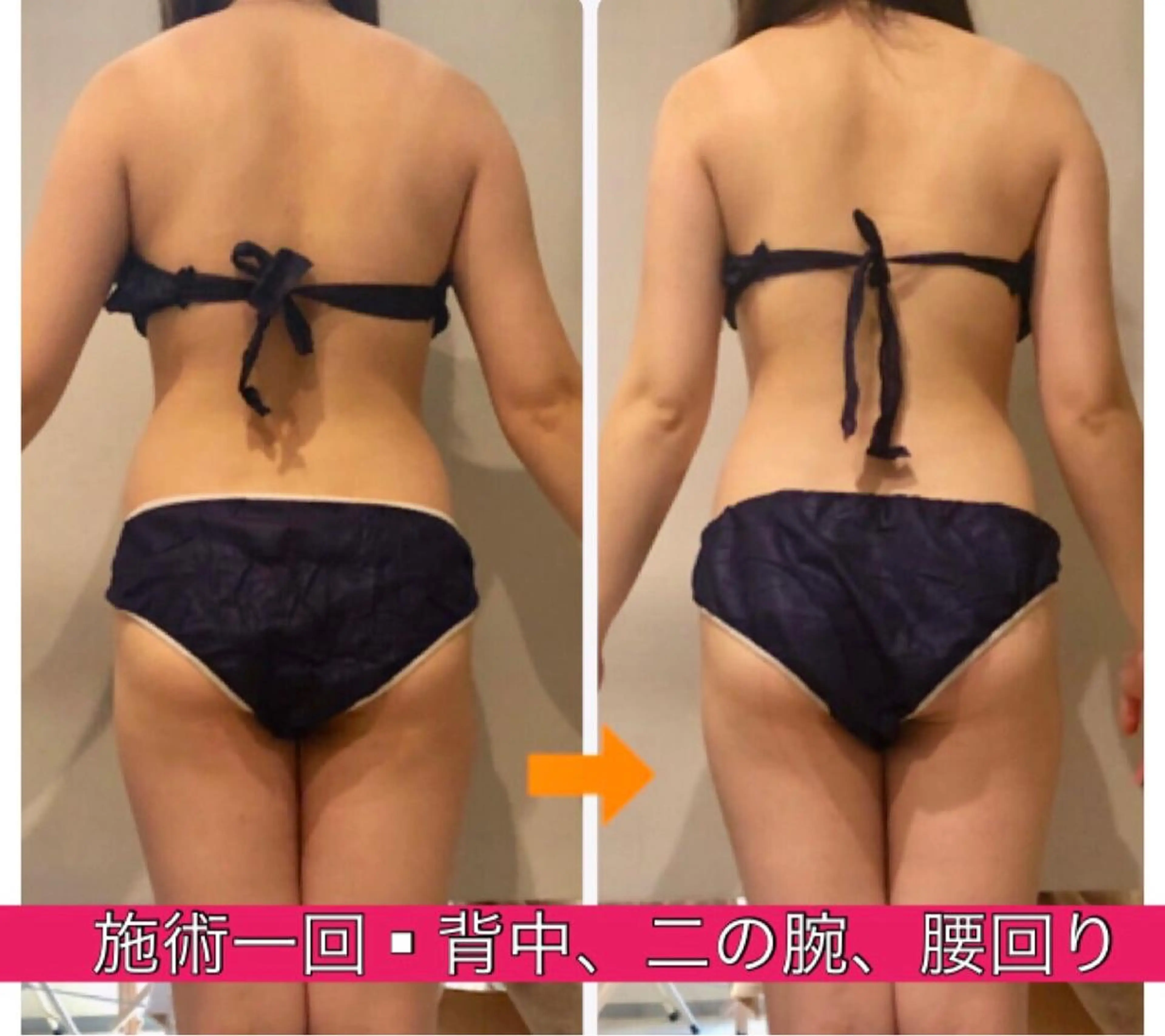 ロング カラー パーマ ヘアアレンジ メンズ キッズ ネイル マツエク・マツパ ‍痩身＆ボディ 結果出し🌟丹野のエステ・リラクイメージ