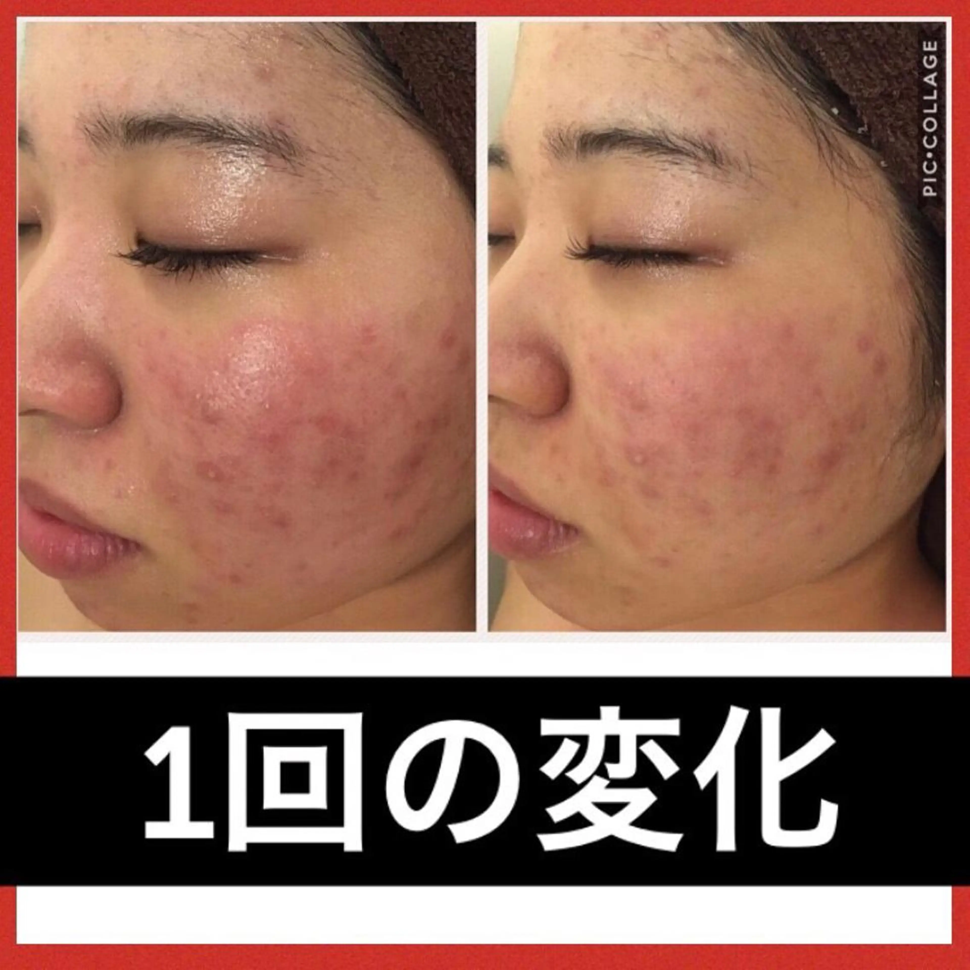 ミディアム カラー パーマ ヘアアレンジ メンズ キッズ ネイル マツエク・マツパ ニキビ・肌質改善専門 ♡人生が変わるサロンのエステ・リラクイメージ