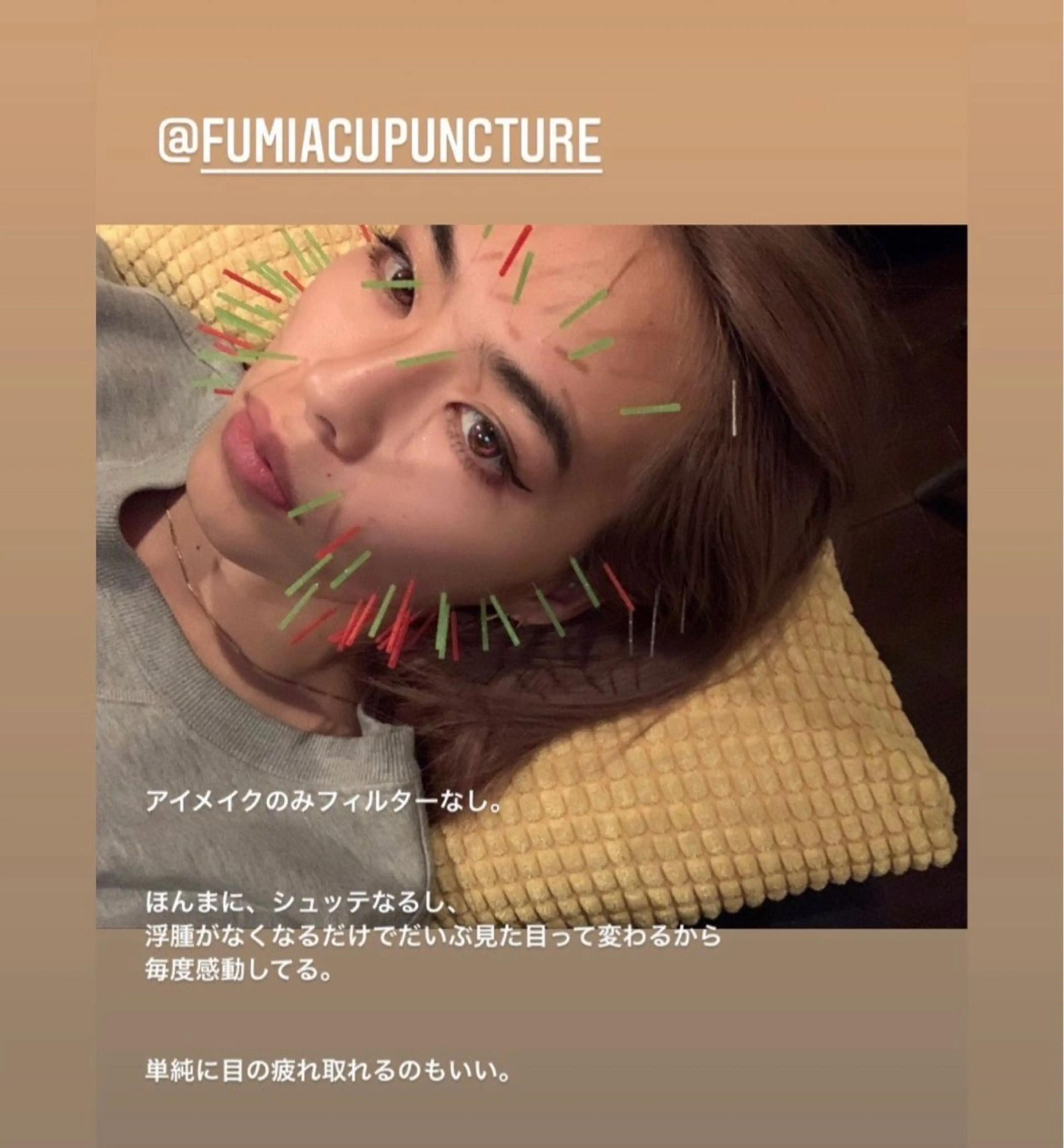 THE  ROOTS所属・美容鍼♡小顔矯正♡ fumikaのエステ・リラクイメージ