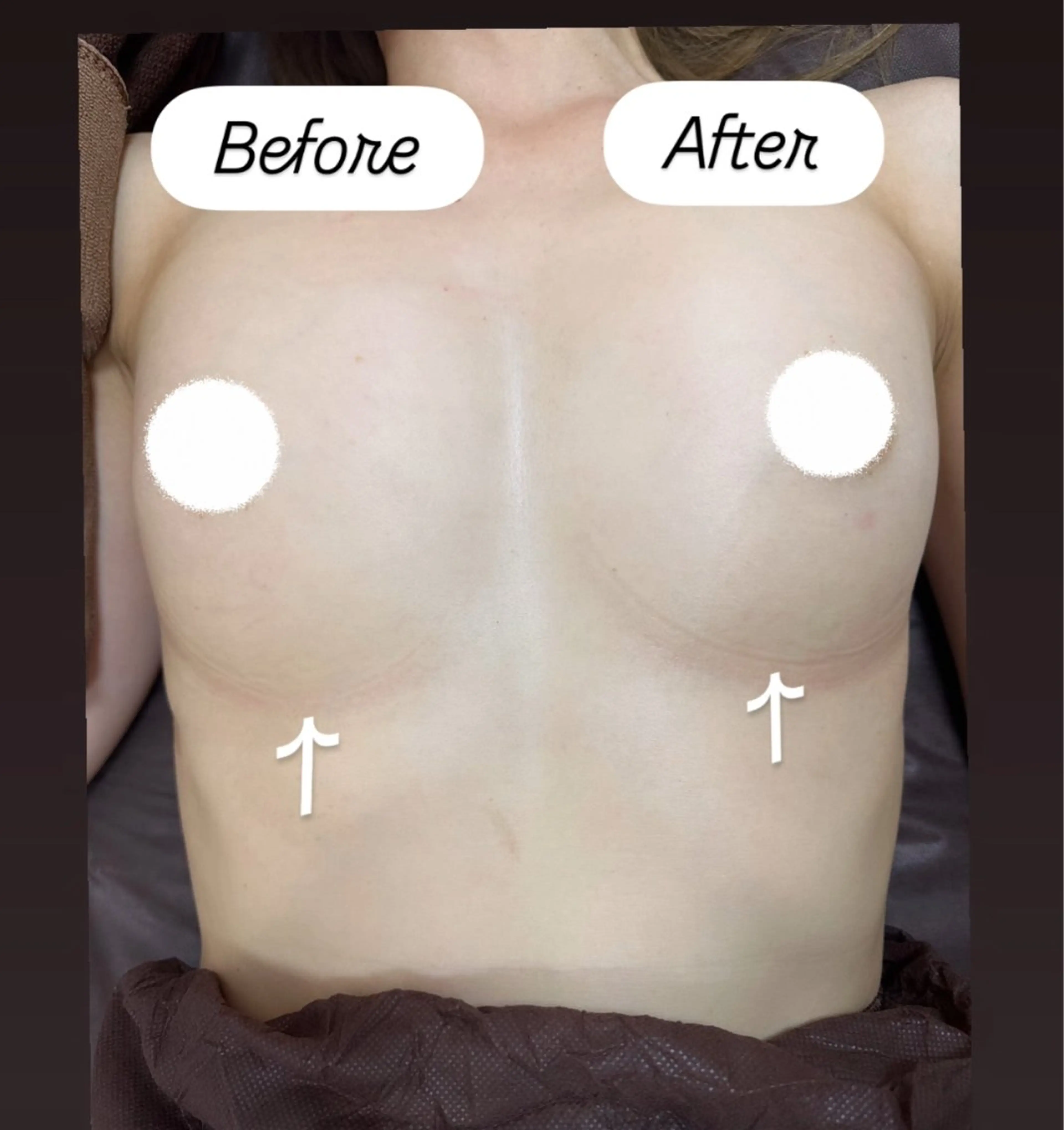 光バストアップ♡ふっくらバストへ🥧の写真