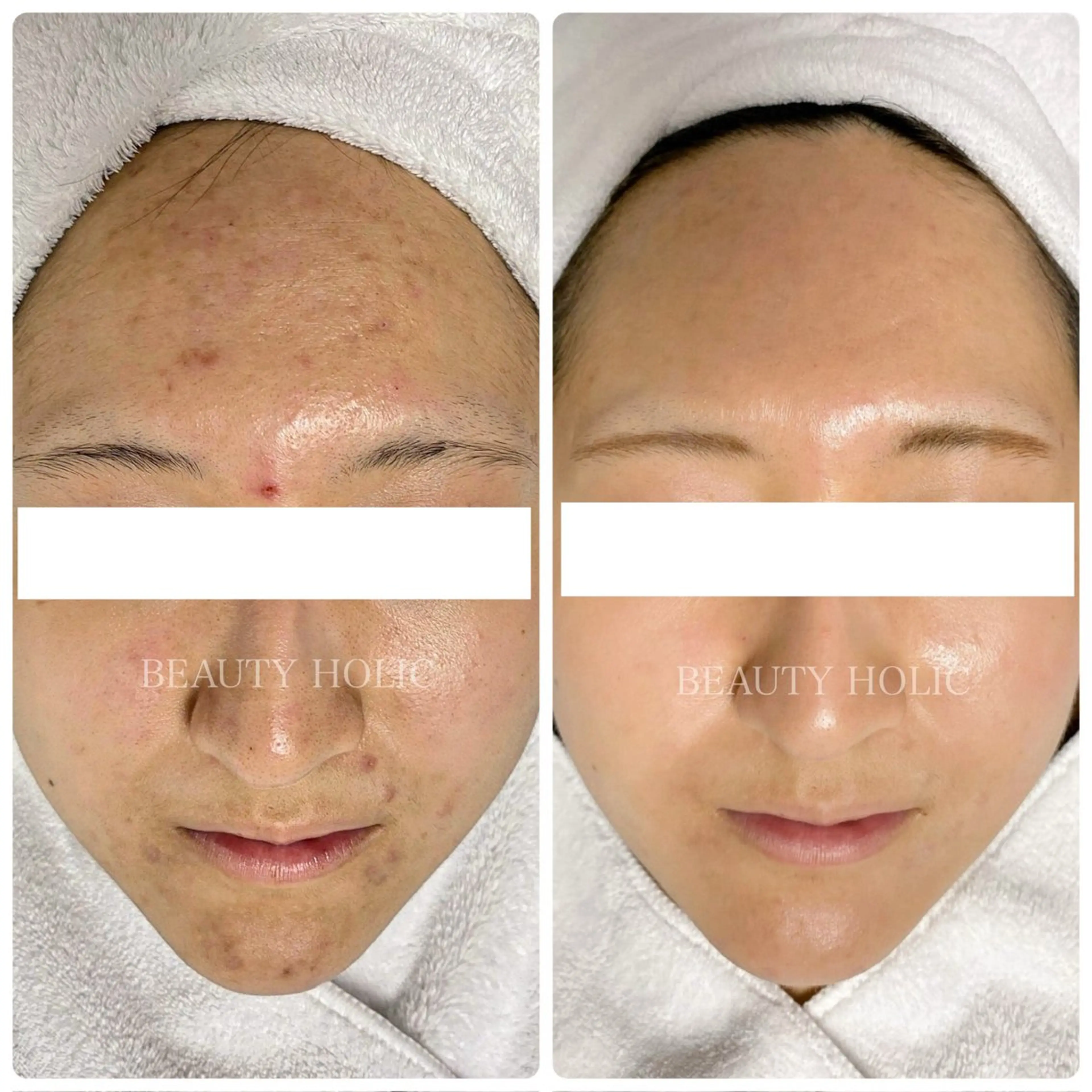 エステ リラク ニキビ・ 肌荒れ専門店のエステ・リラクイメージ