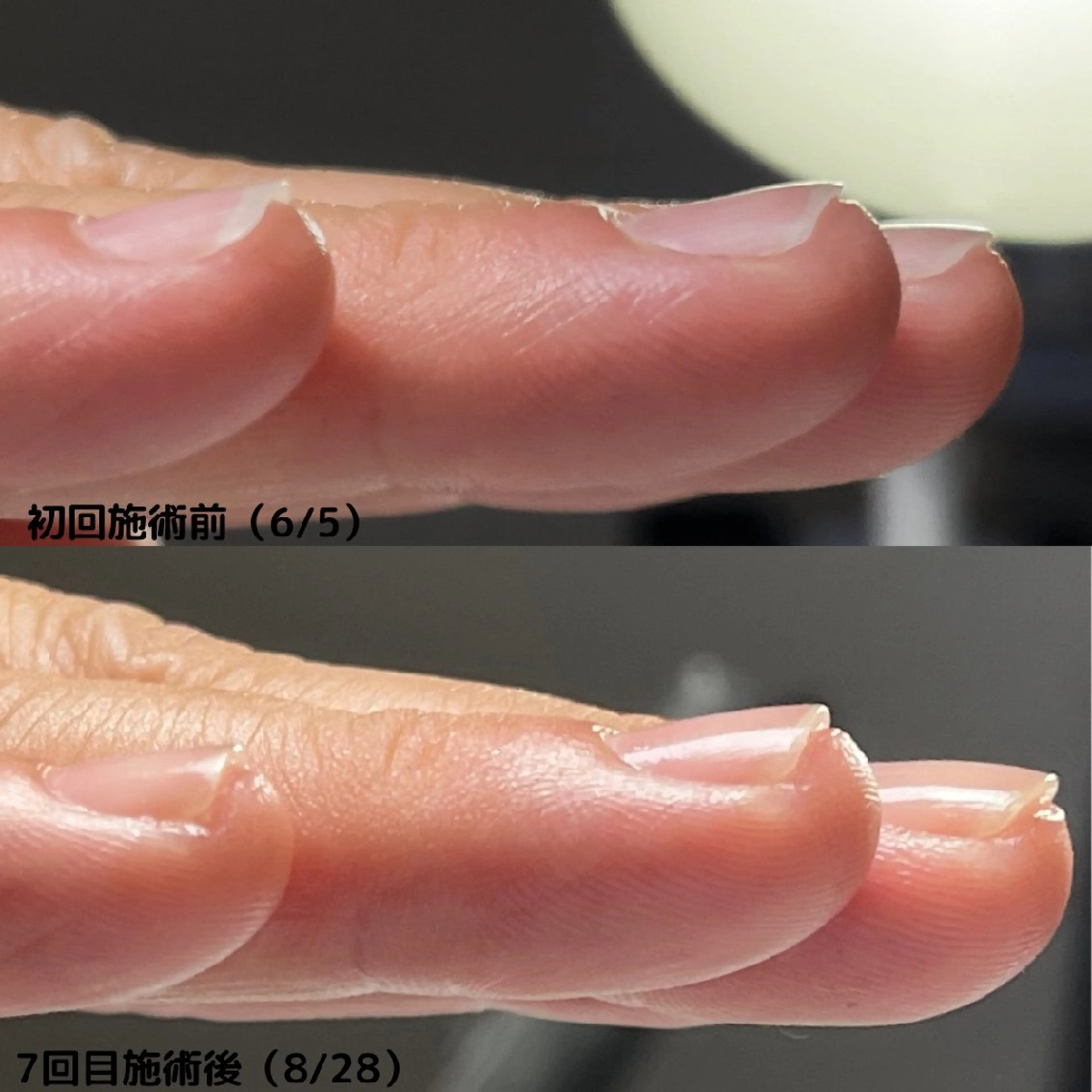 ネイル nail 1623のネイルデザイン