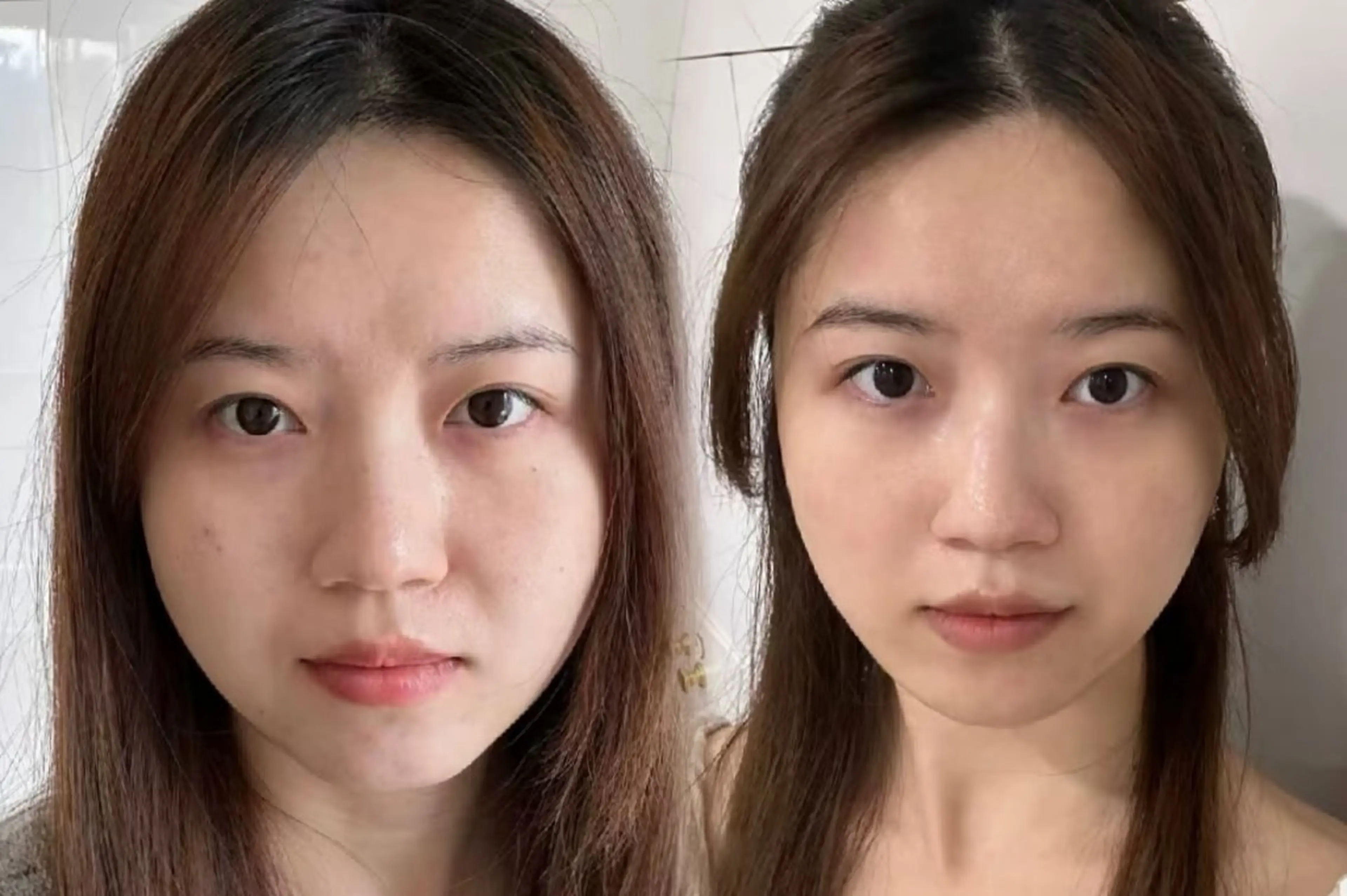 その他 aliaハイフ&水光ジェットサロン所属・aliaハーブ水光店 エステティシャン募集のエステ・リラクイメージ