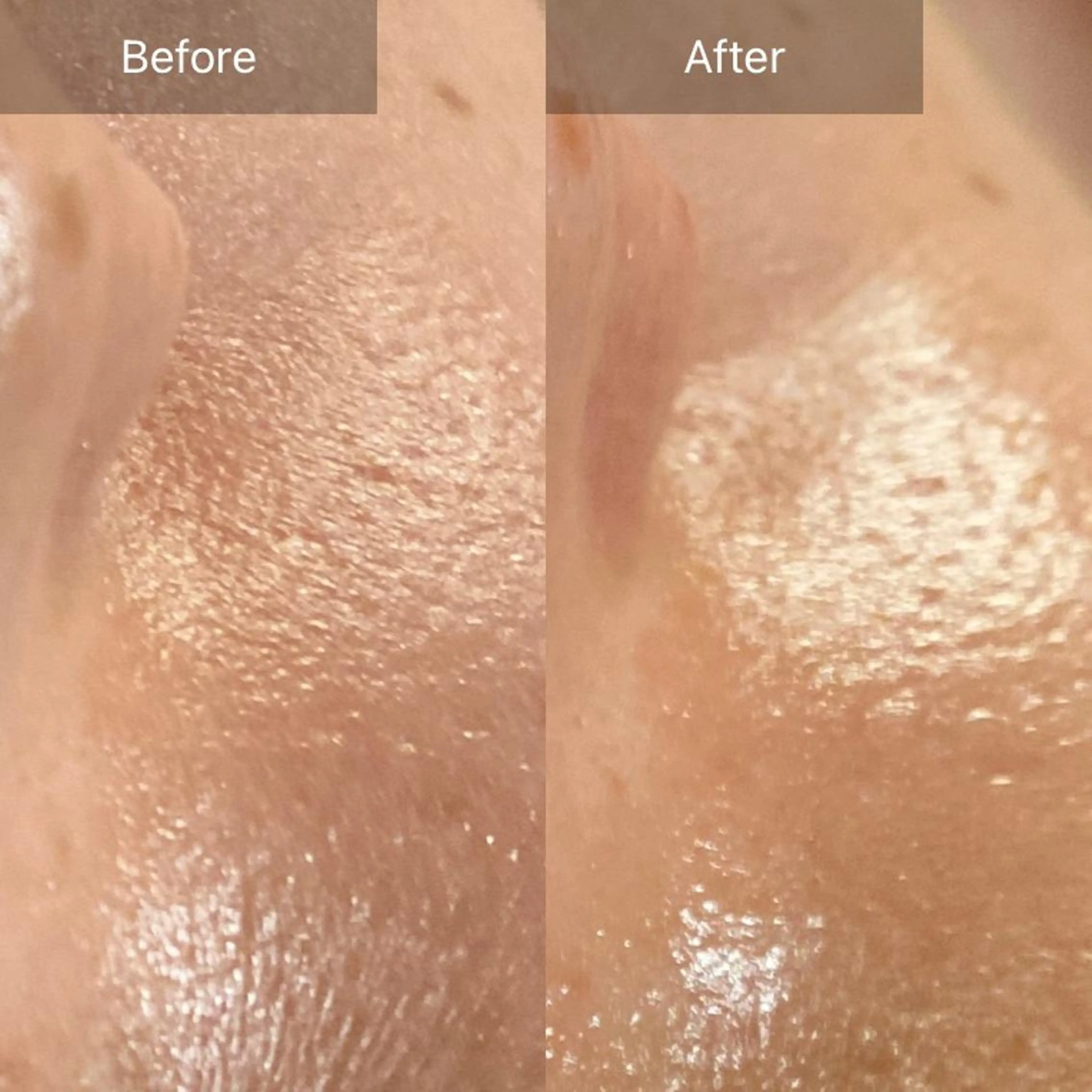 Mandarin Orange所属・毛穴から始める肌メン テマンダリンオレンジのエステ・リラクイメージ