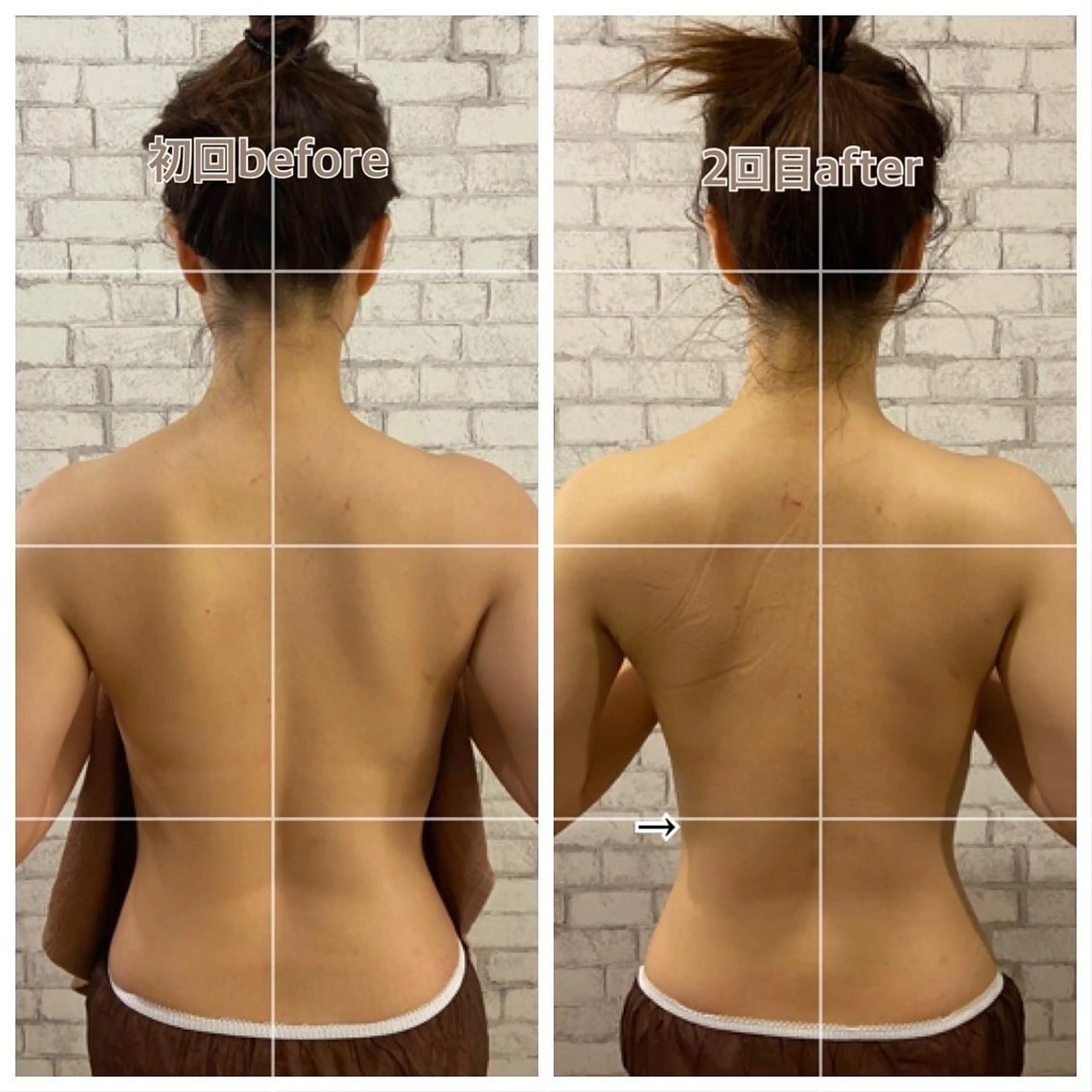 salon ace所属・【小顔矯正】 salonaceのエステ・リラクイメージ