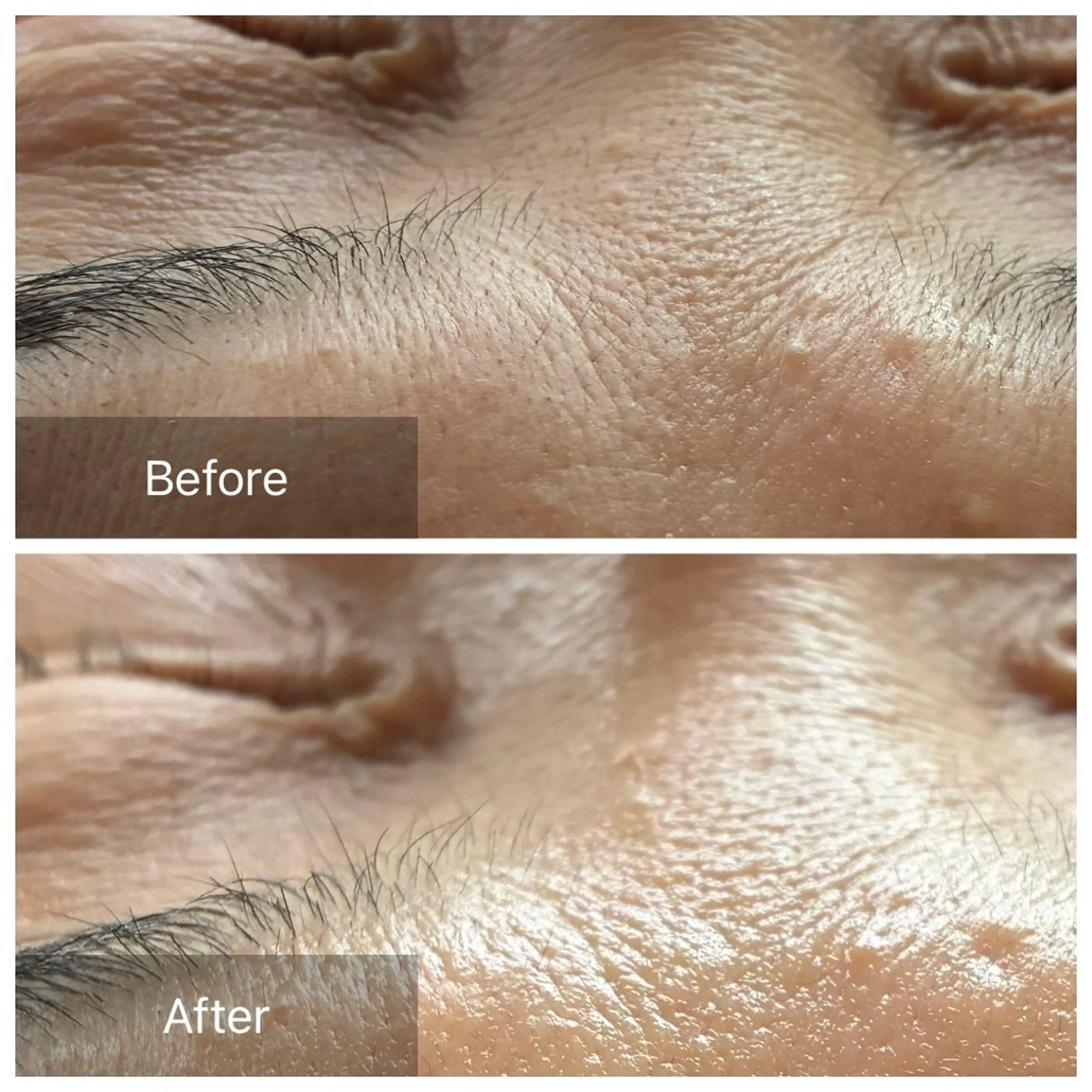 脱毛 産毛専門店 Bittoのエステ・リラクイメージ