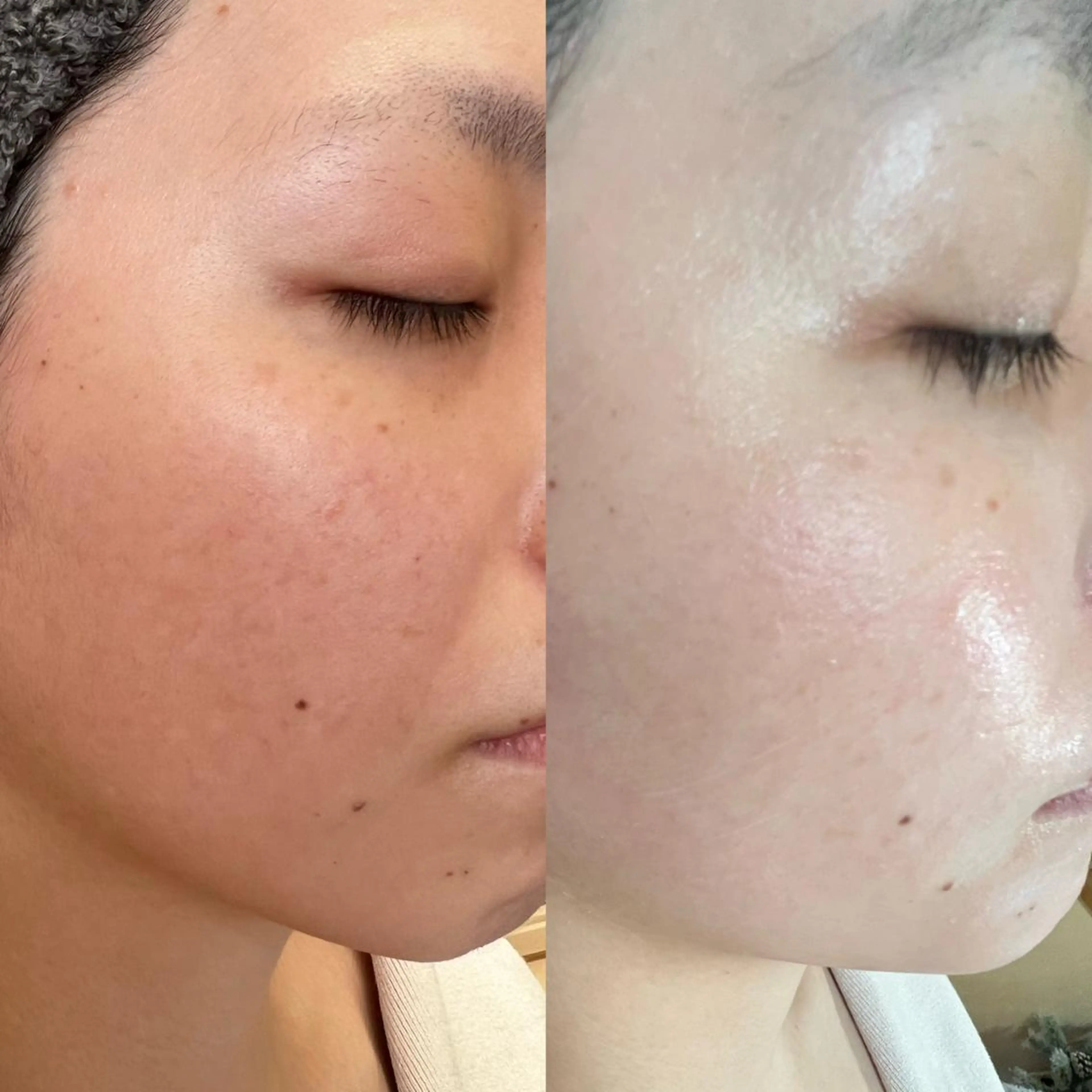 Dimples所属・Dimples ERINAのエステ・リラクイメージ