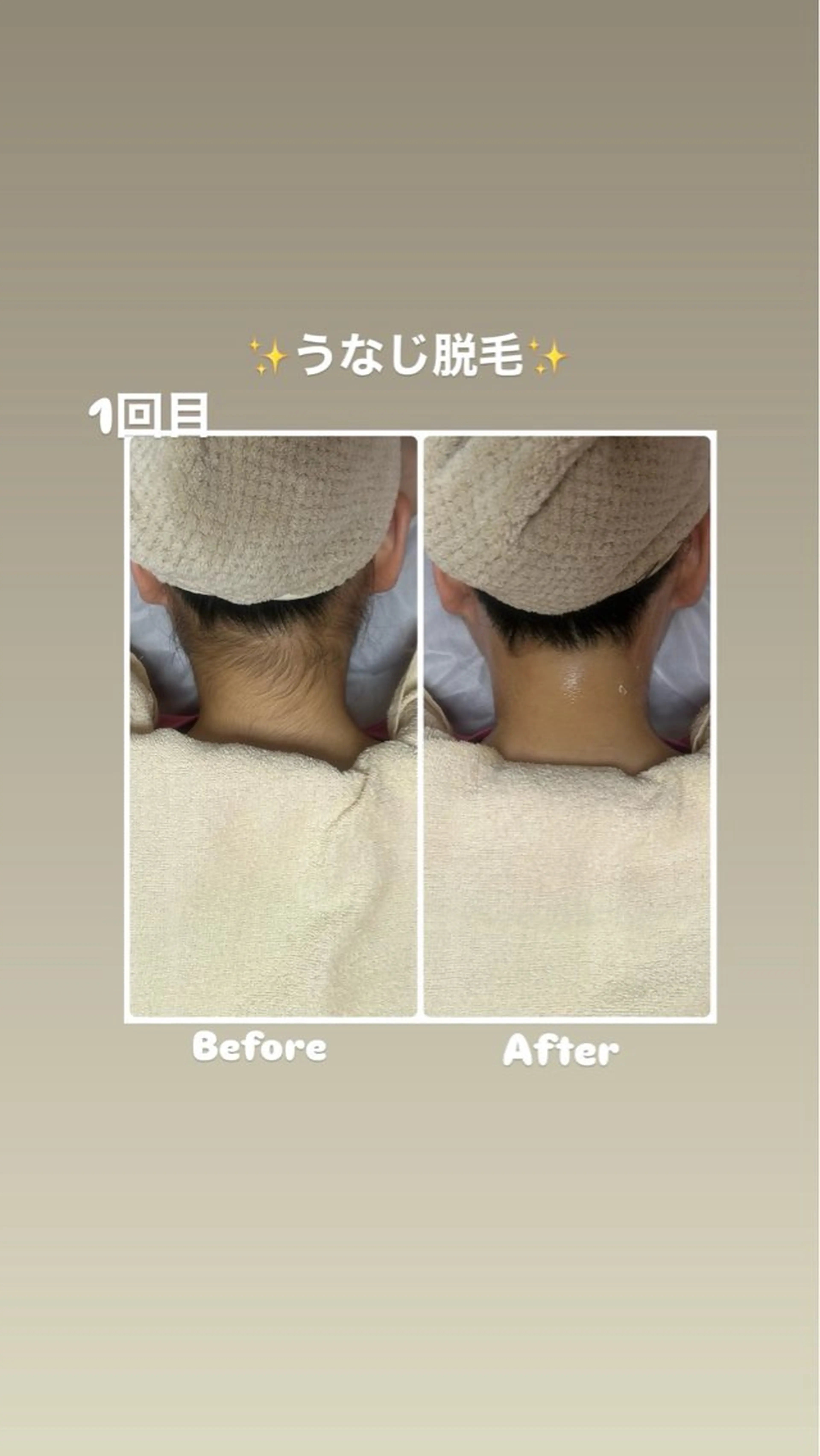 エステ 脱毛サロン エクボスタッフのエステ・リラクイメージ