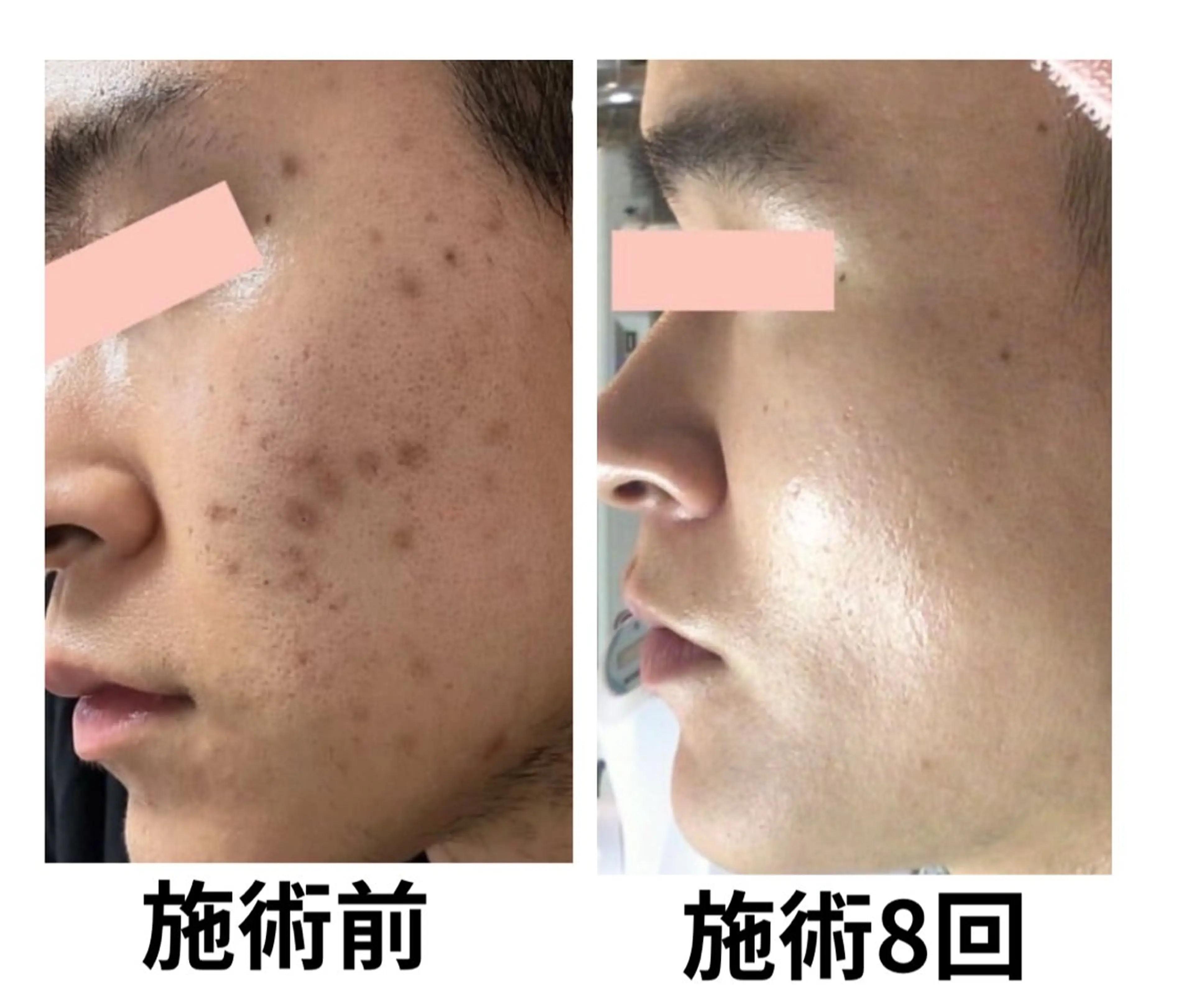 フェイシャルエステサロン 　グレースティー所属・毛穴・ニキビ専門 エステグレースティーのエステ・リラクイメージ