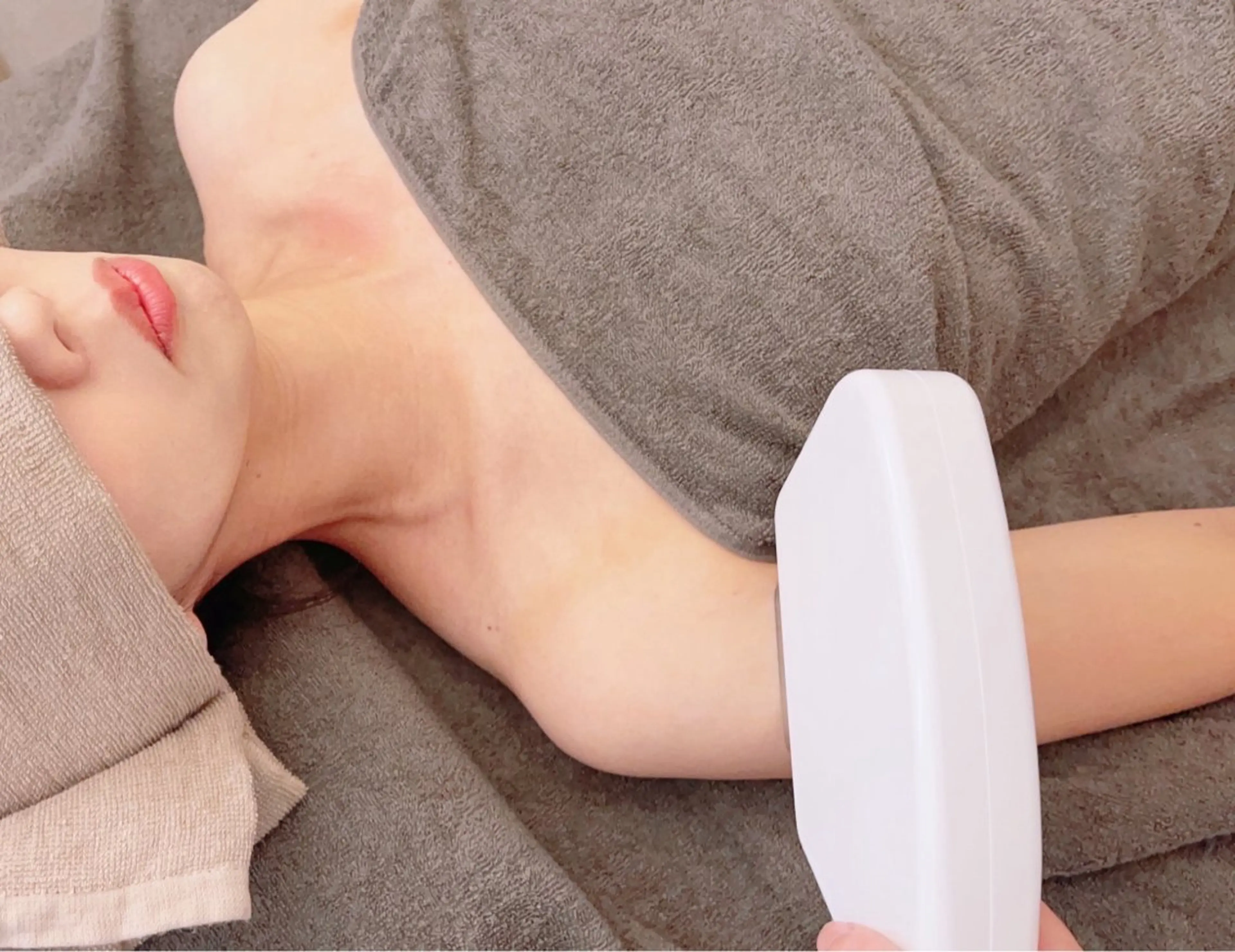 脇脱毛☆の写真