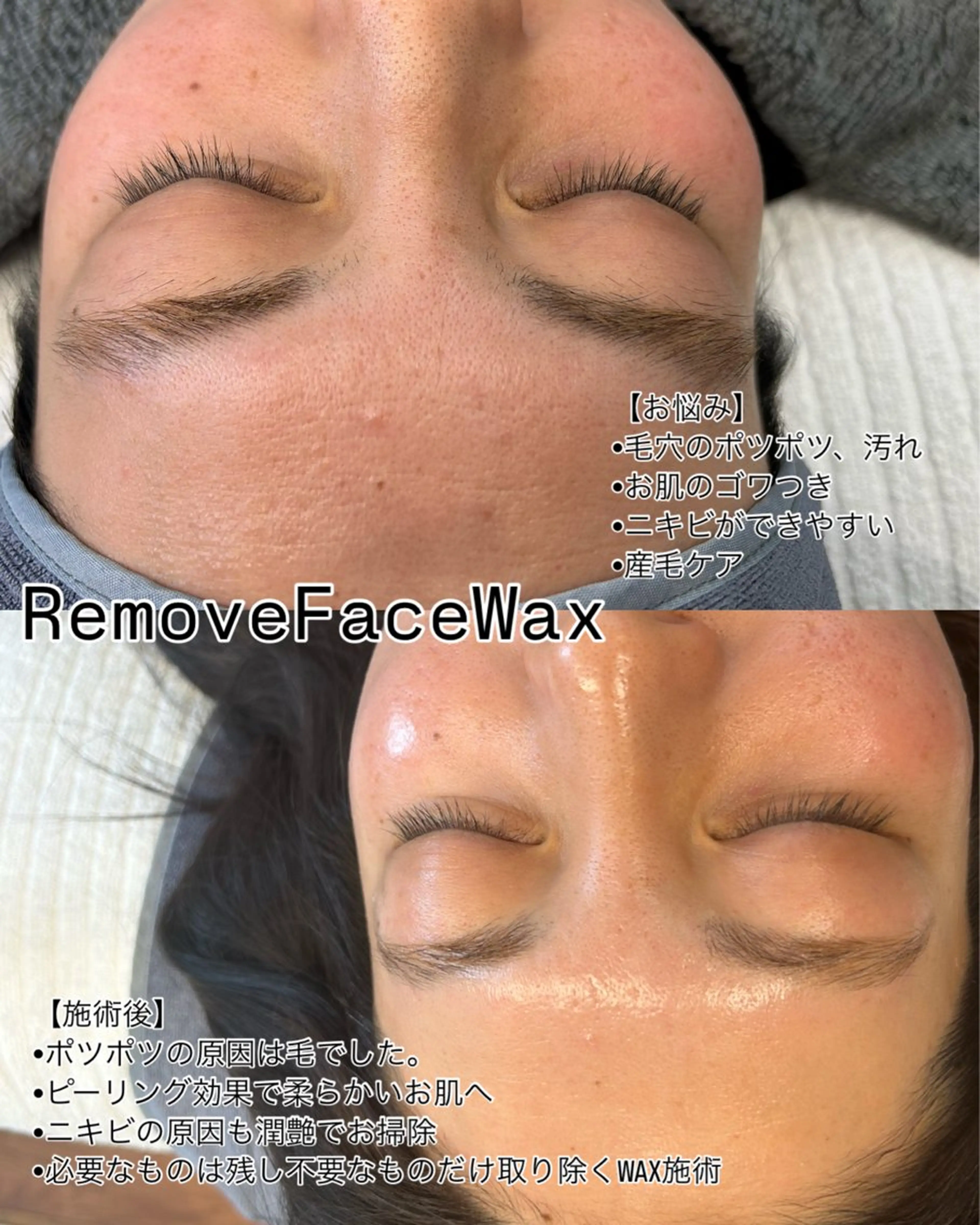 Remove所属・Remove .のエステ・リラクイメージ