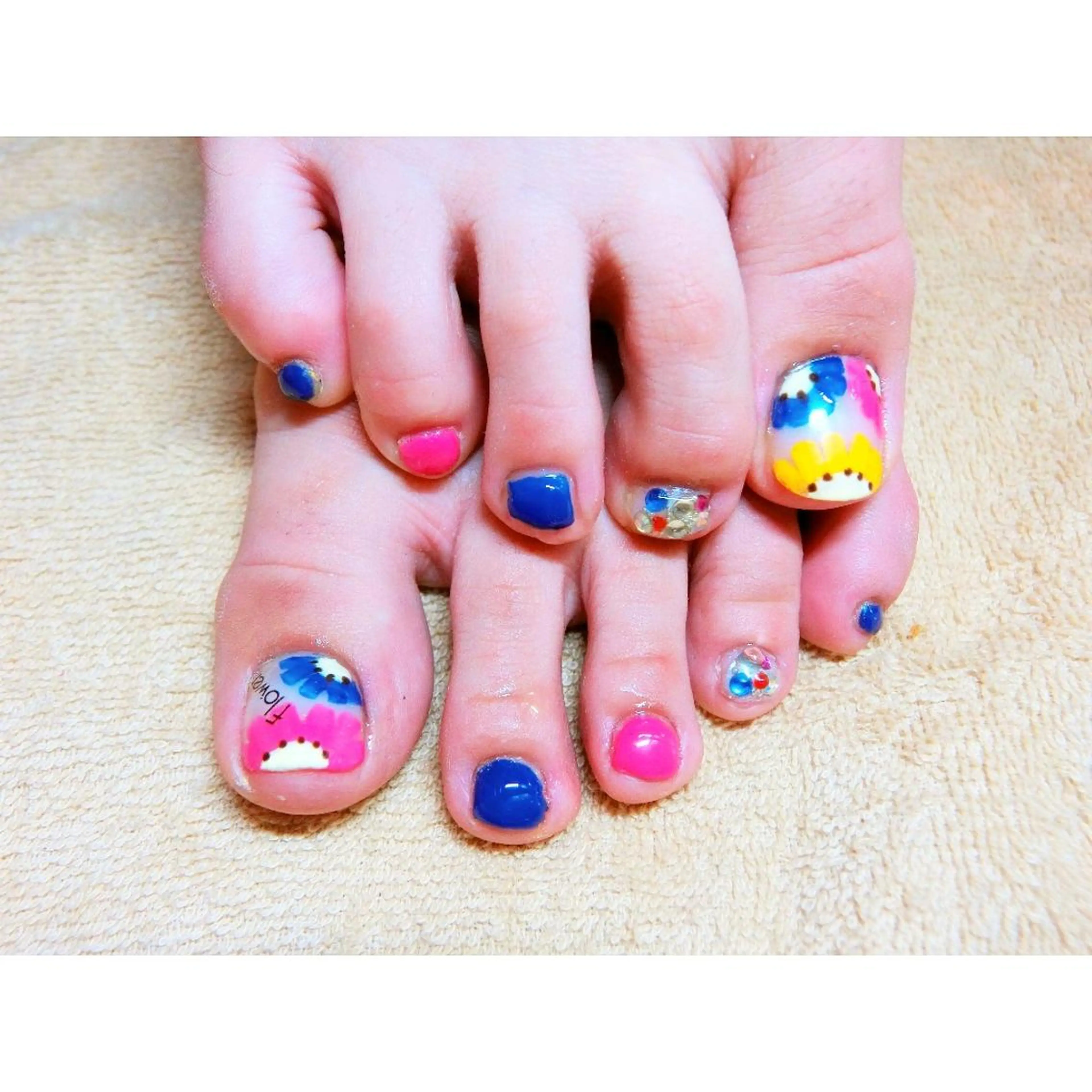 ネイル フットネイル 痛ネイル/ワンホン/ フィルイン/長さだしのネイルデザイン