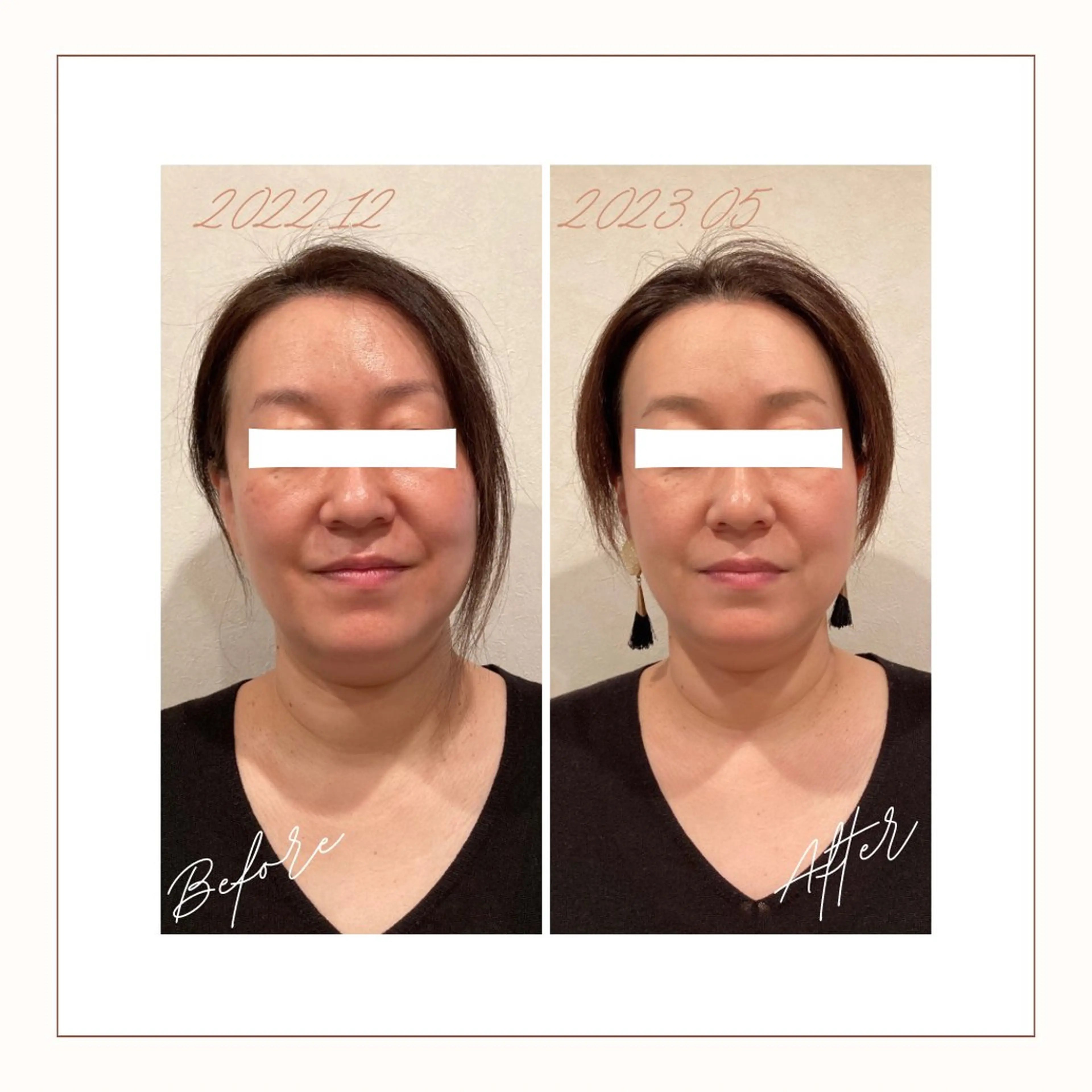 エステ リラク 小顔×肌質改善サロン soin〔ソワン〕のエステ・リラクイメージ