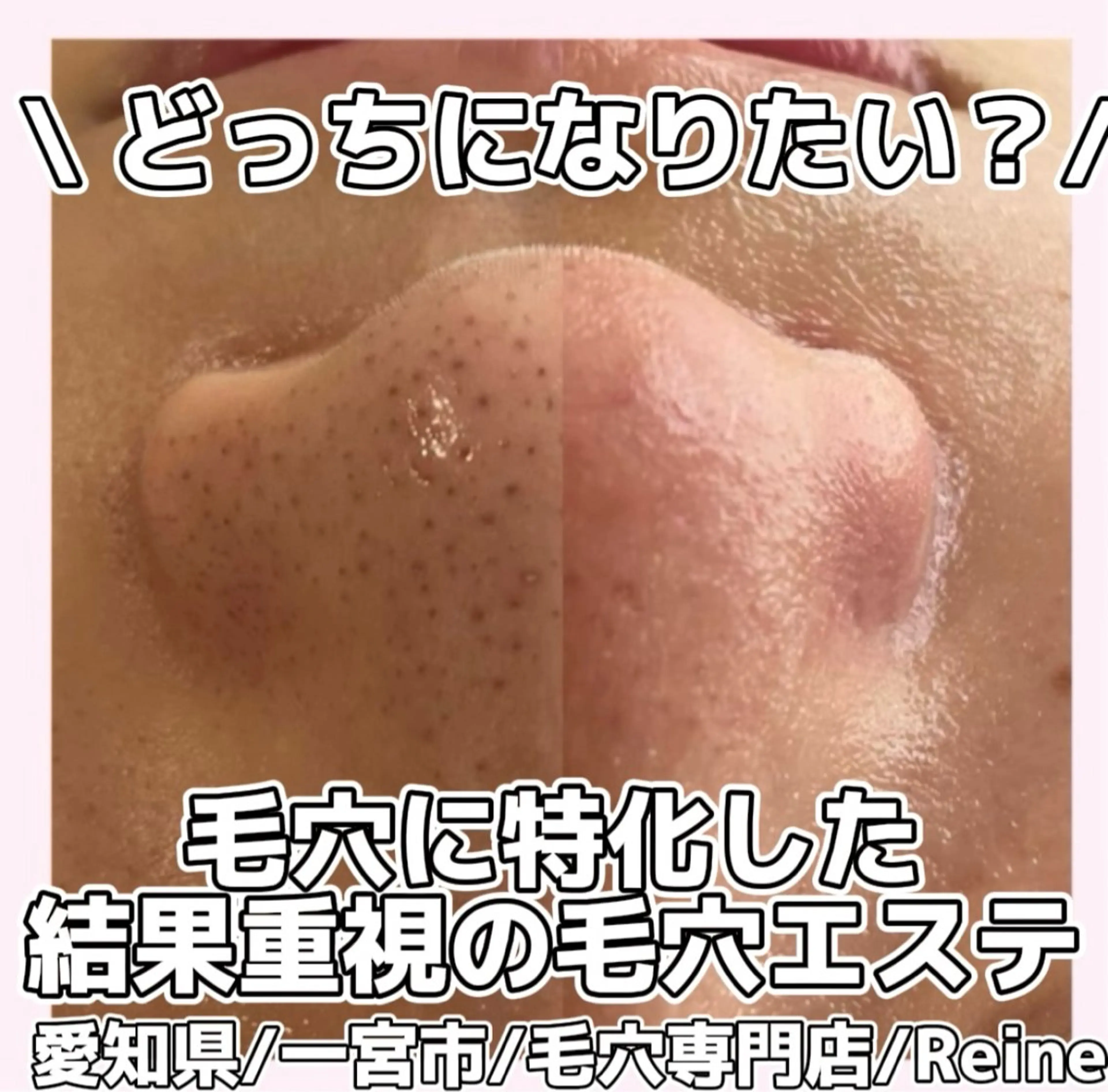 エステ Reine BeautySalon所属・毛穴/シミ肝斑/脱毛 横山梨里のエステ・リラクイメージ