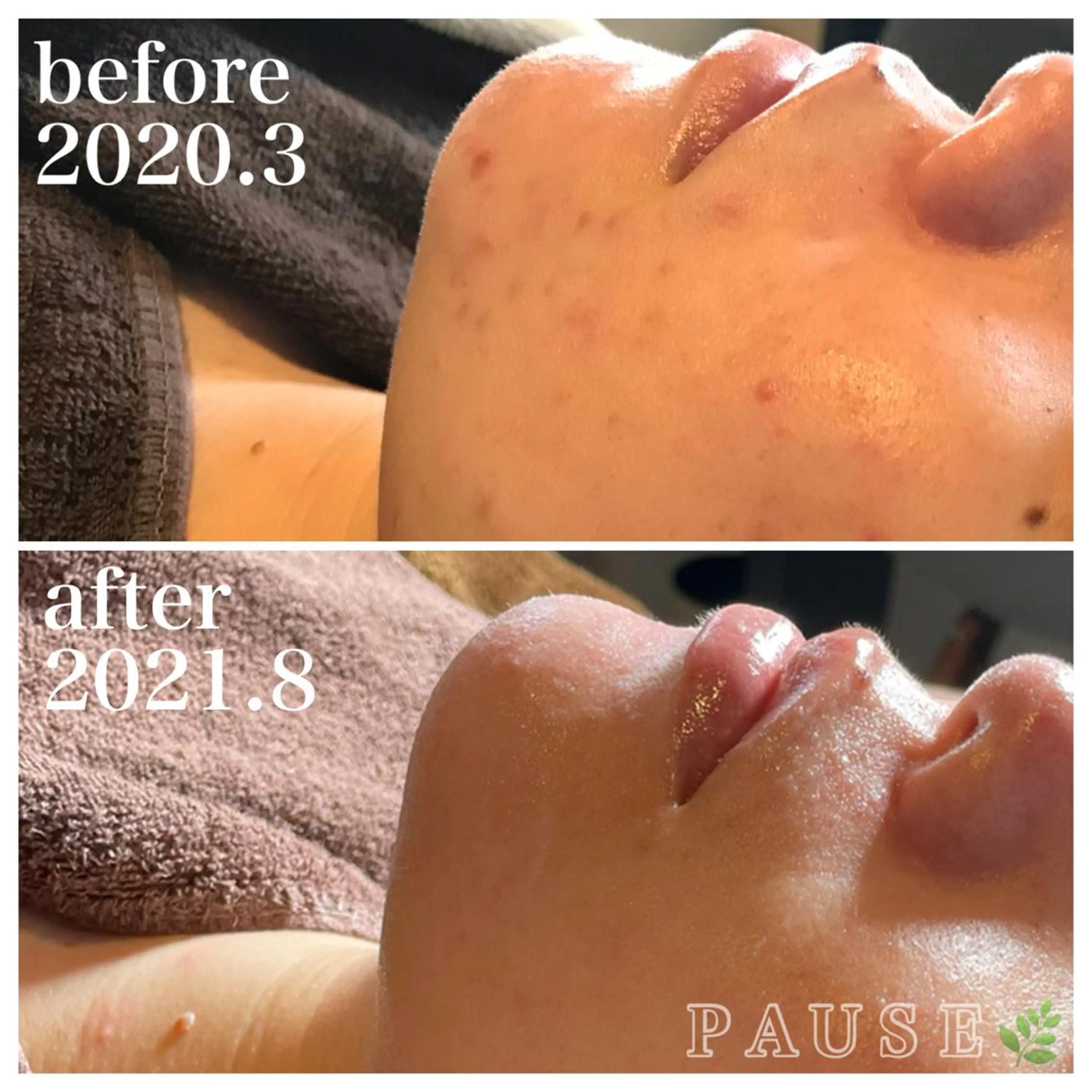 エステ 浜野 恵美のエステ・リラクイメージ